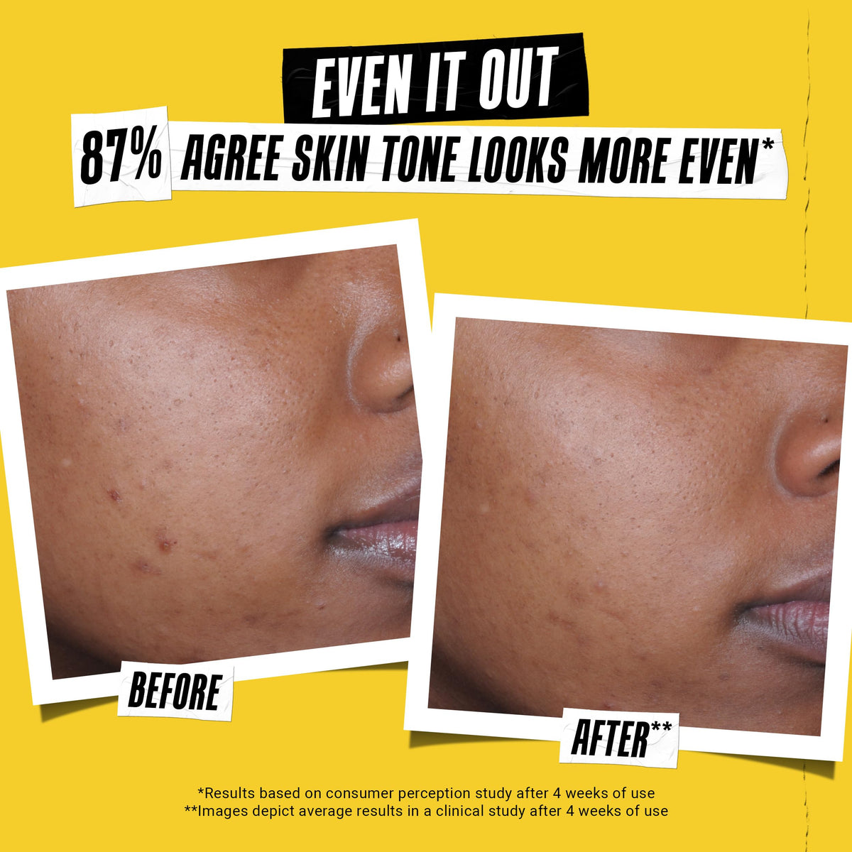Kiehl's - Better Screen UV Serum SPF 50+ Facial Sunscreen, Collagen Peptide | Facial Sunscreen for Shielding UVA & UVB -