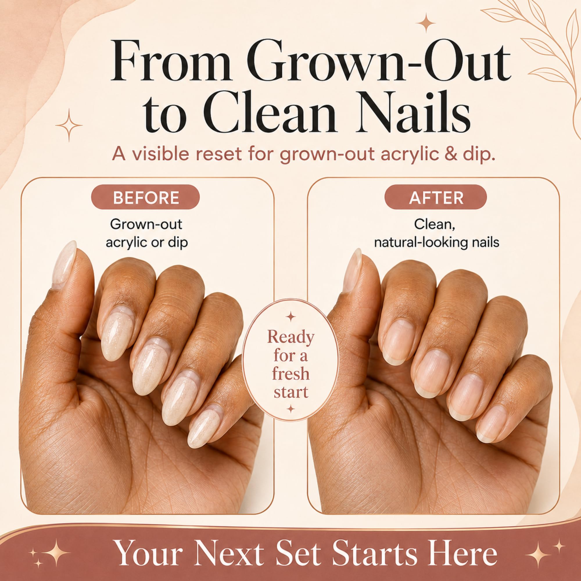 Willowash Electric Nail Remover Kit by Saint Willo