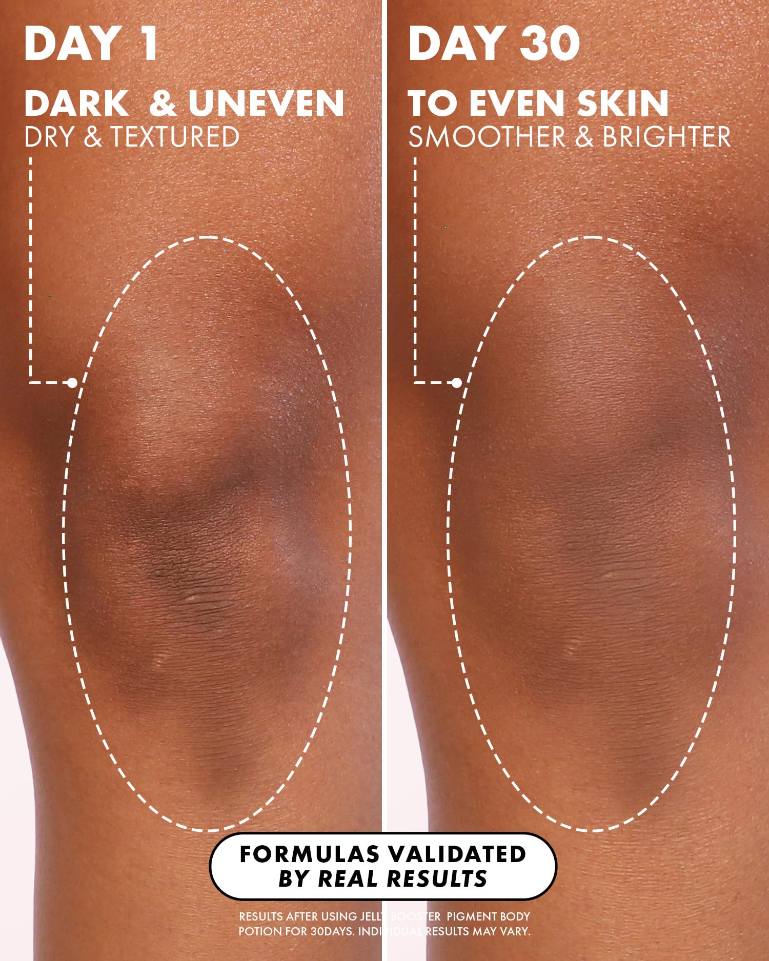 Truly Beauty Jelly Booster Pigment Body Potion | Dark Spot & Discoloration