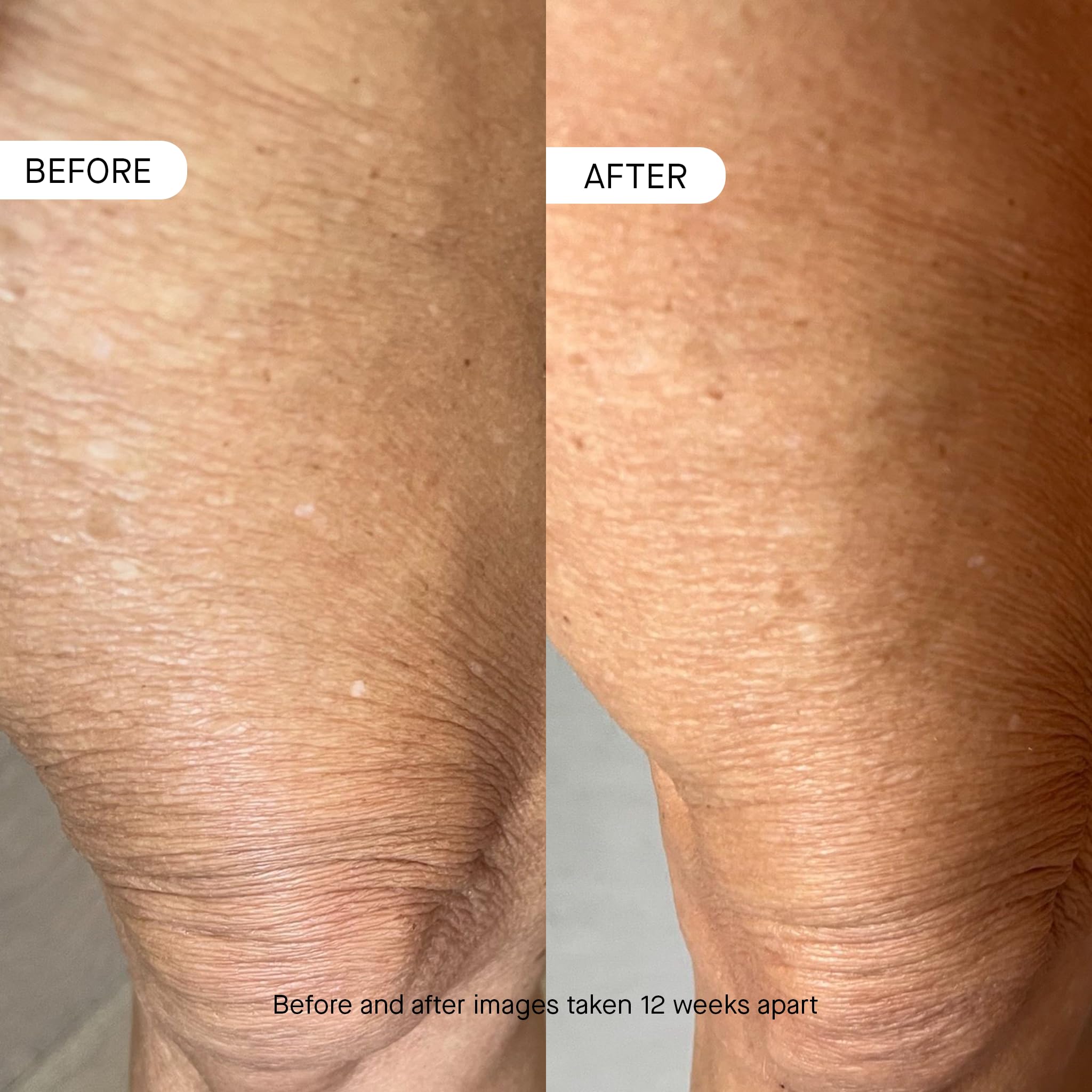 OneSkin OS-01 Body Topical Supplement Moisturizer 8.45oz