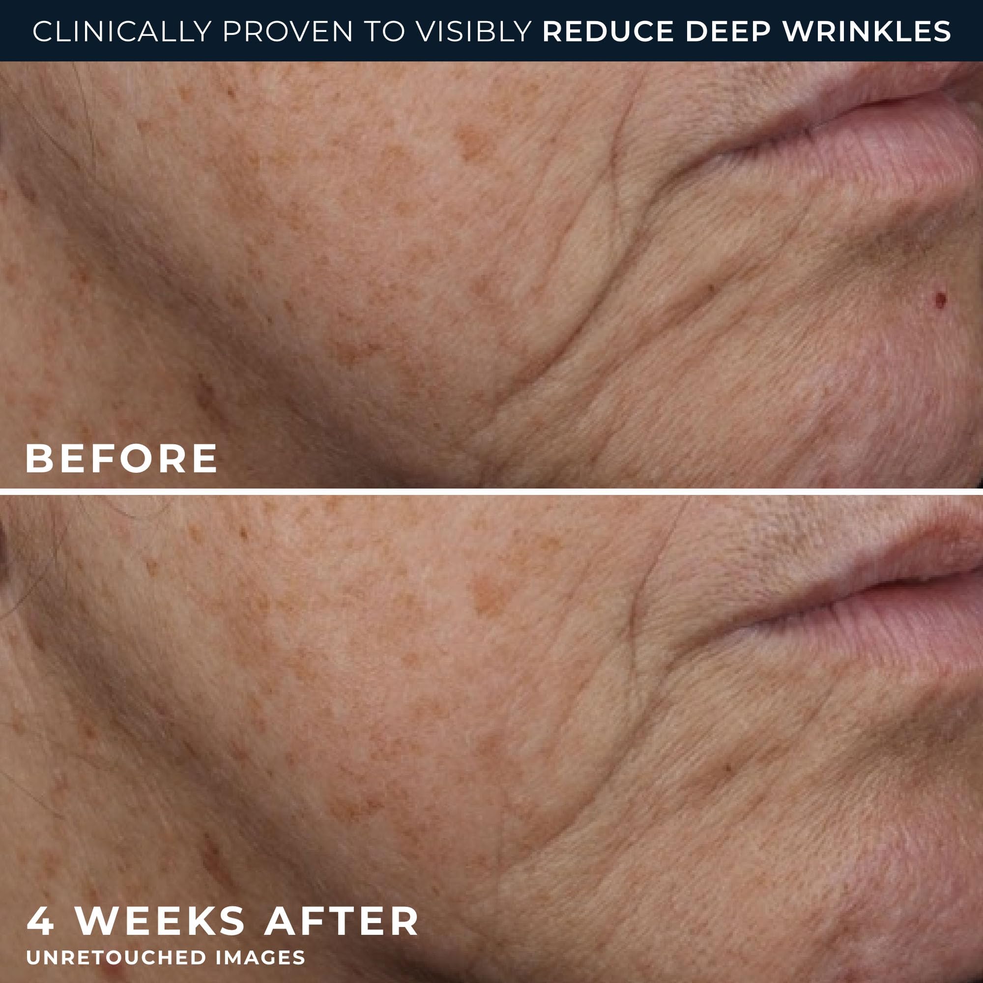 RoC Deep Wrinkle Rich Cream, fragrance-free anti-aging moisturizer in a jar, designed to firm and hydrate mature skin.