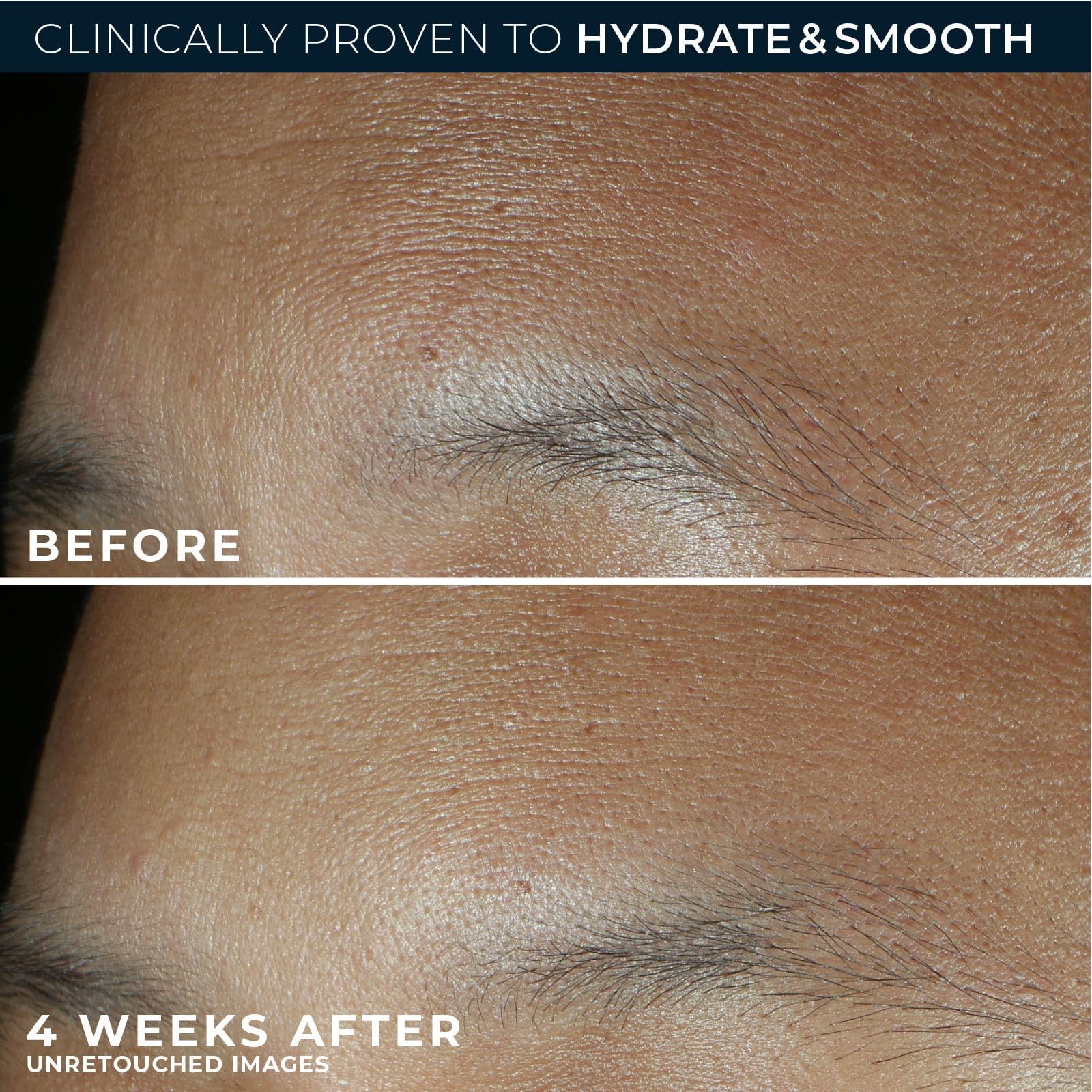 RoC Retinol Correxion Max Hydration Cream in 1.7 oz jar, smooth moisturizer for skin hydration and anti-aging benefits.