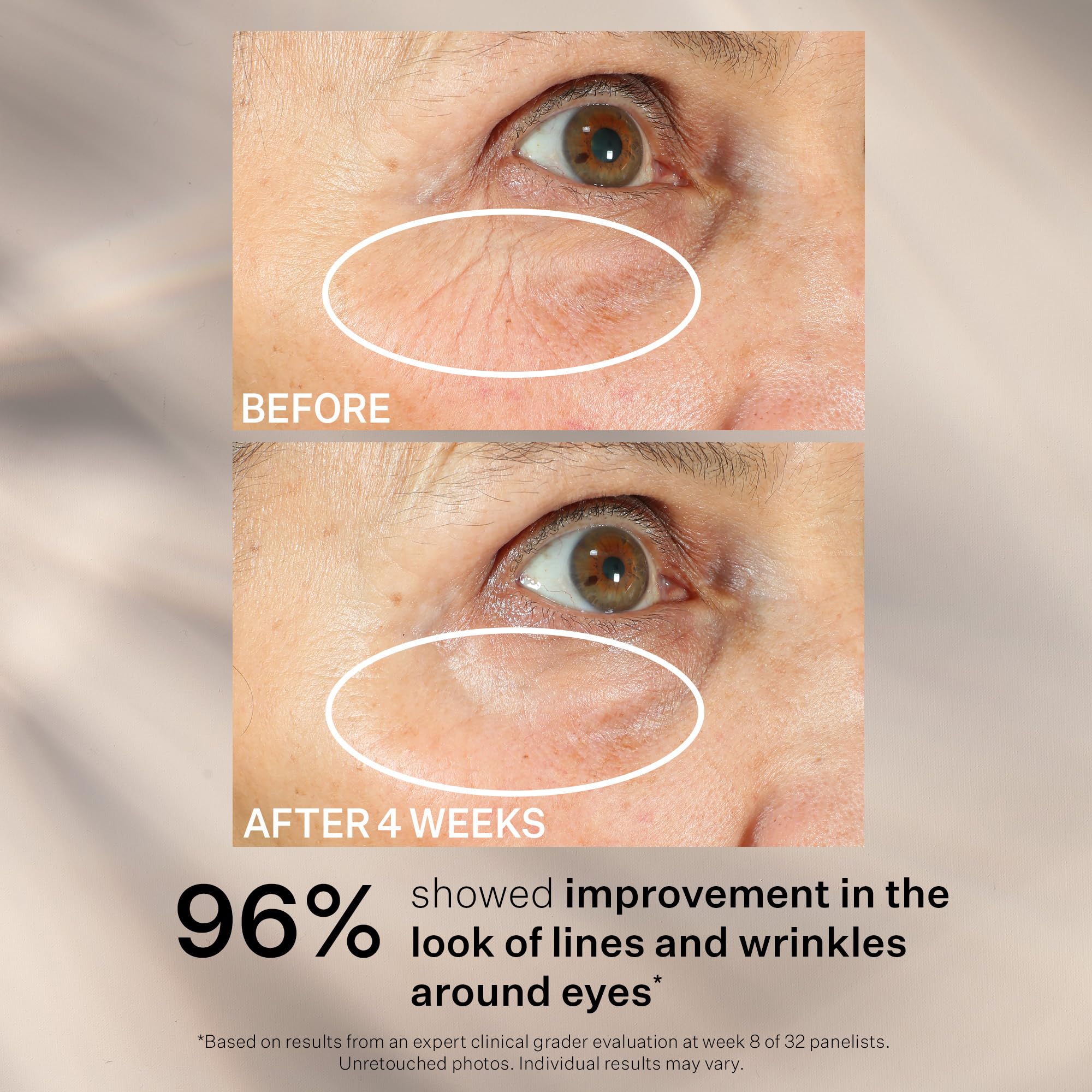 StriVectin Peptight® 360° eye serum in a 1 oz bottle, featuring a clear glass container with a pump dispenser for tightening and brightening.