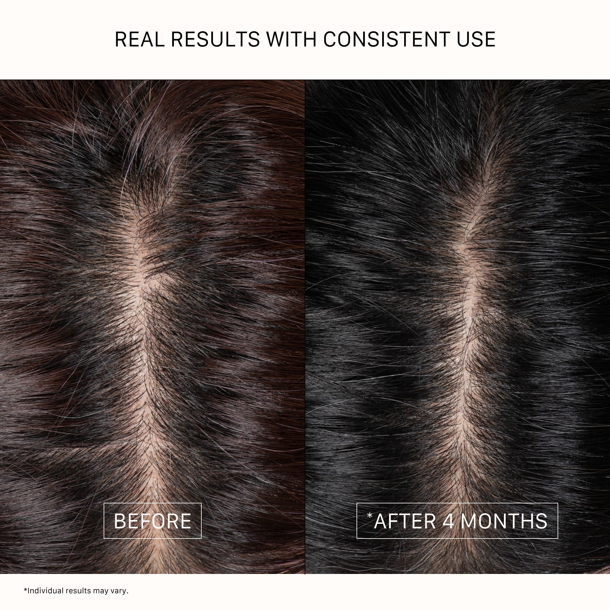 ACTIIV Densifying Hair Serum in 1.8 fl oz bottle, water-based topical treatment for hair density and regrowth.