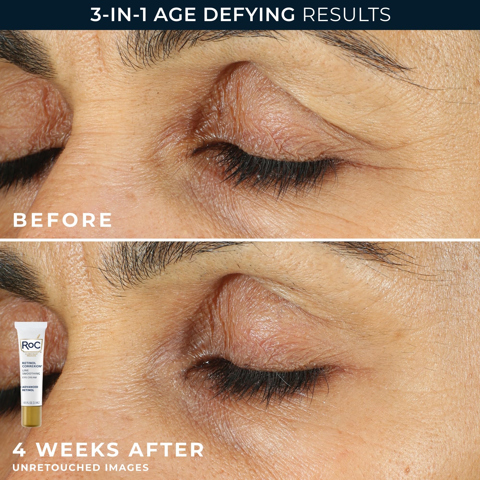 RoC Retinol Correxion skin moisturizer set with deep wrinkle night cream and eye cream, featuring creamy textures and skincare packaging.
