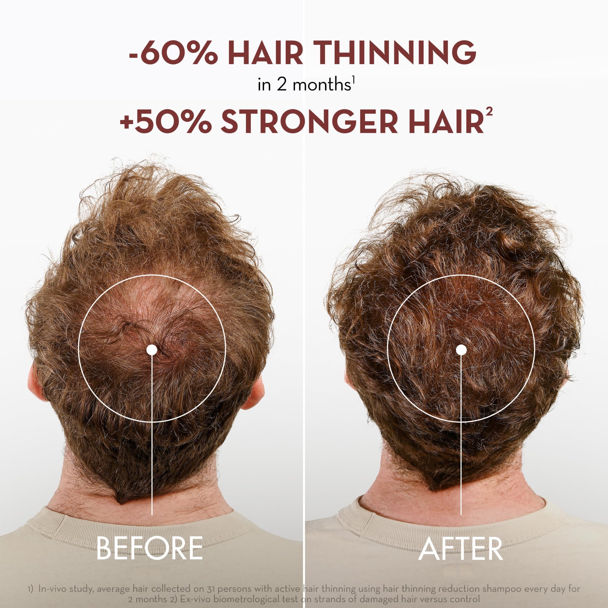 Klorane Quinine Thickening Shampoo for hair loss, 13.5 oz, showing the shampoo bottle with label and product details