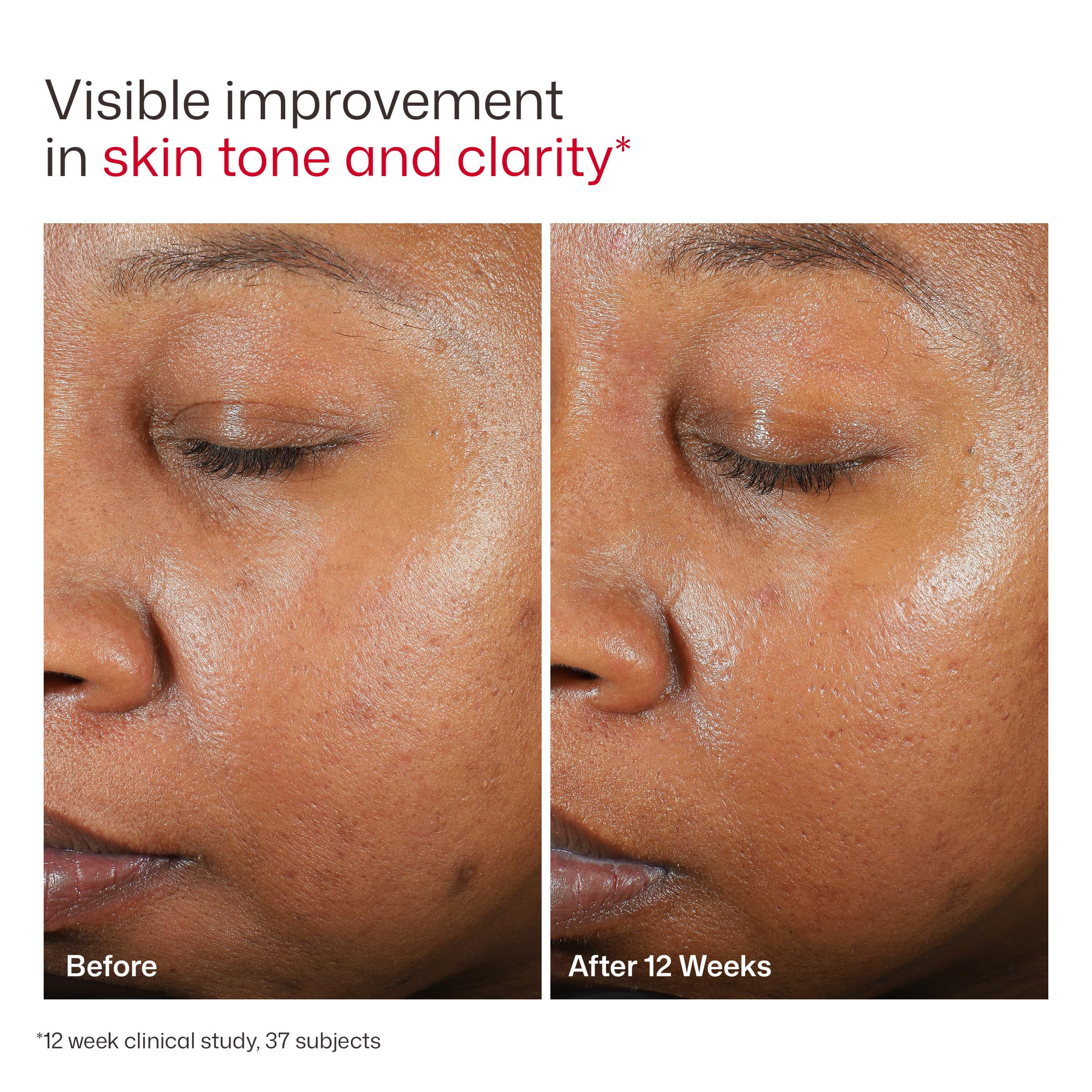 EltaMD UV Clear Tinted Face Sunscreen SPF 46 – 1.7 oz