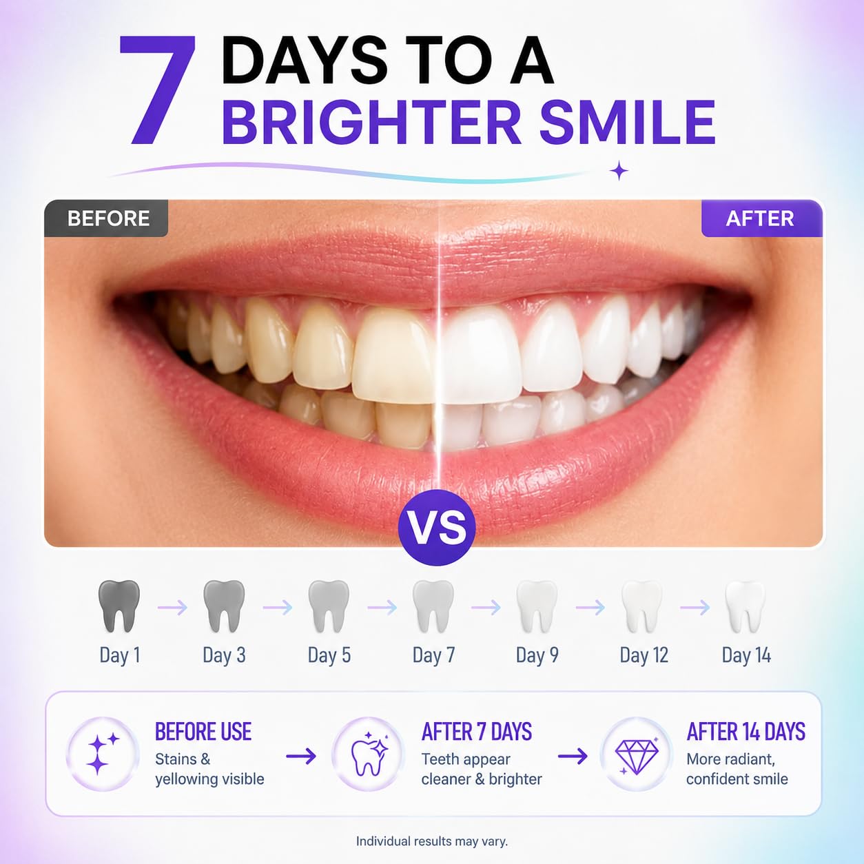 AISU LAB Whitening Strips for Sensitive Teeth, 14 treatments, showing the strips in a box with clear branding on the packaging.