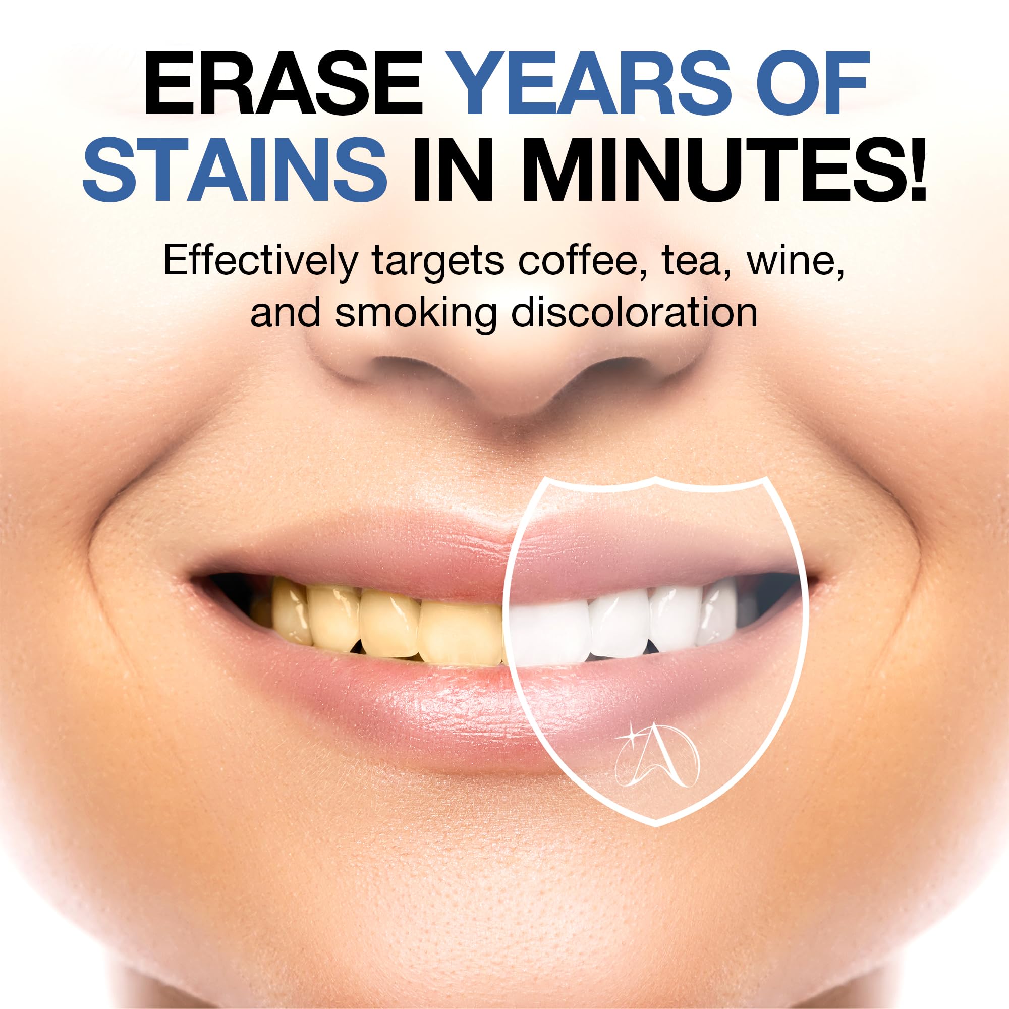 ALTEGAORI Teeth Whitening Strips for 14 treatments, showing the box and strips ready for use on a clean background.