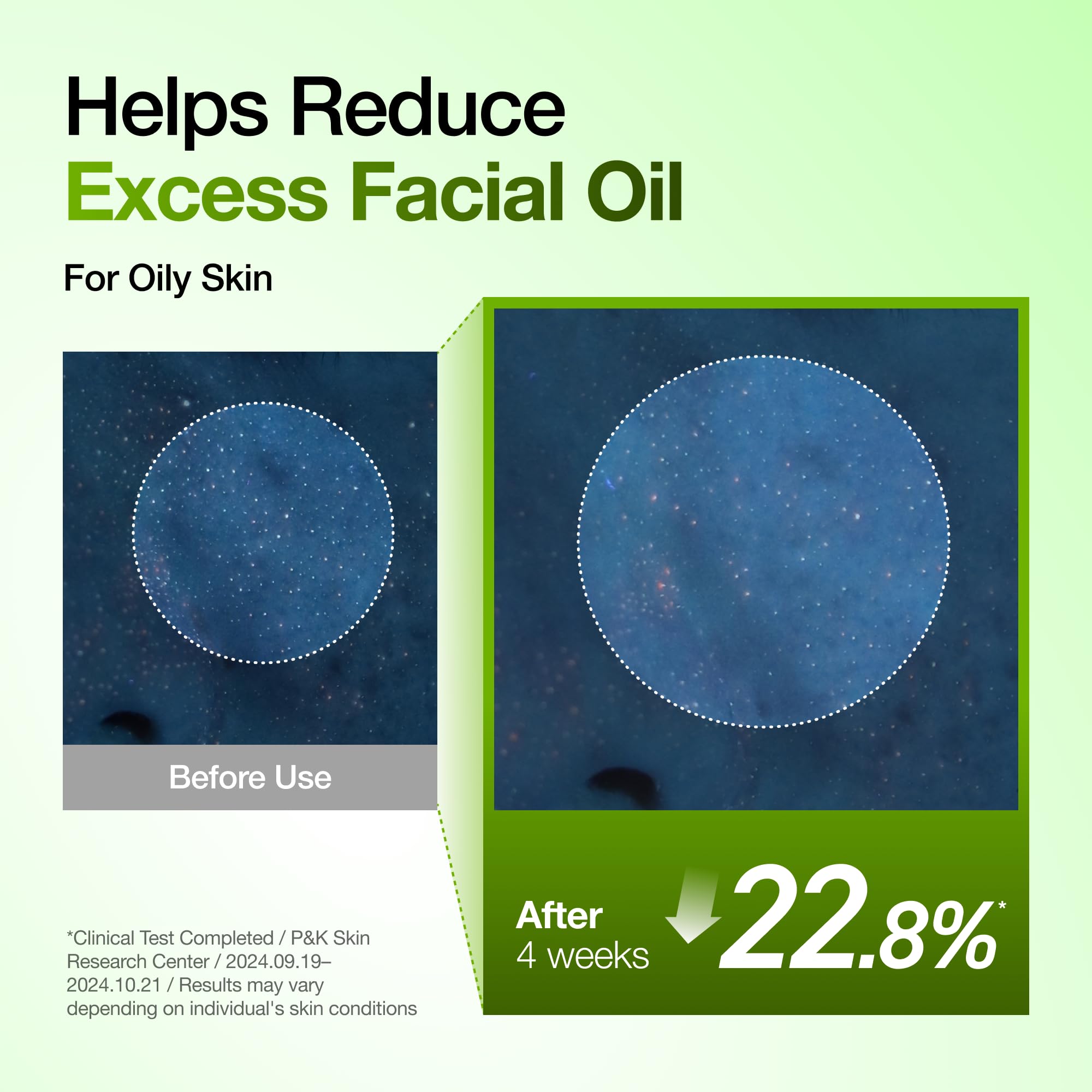 ANUA Azelaic Acid 10% Redness Soothing Serum in 1.01oz bottle, showing the clear serum and sleek packaging.