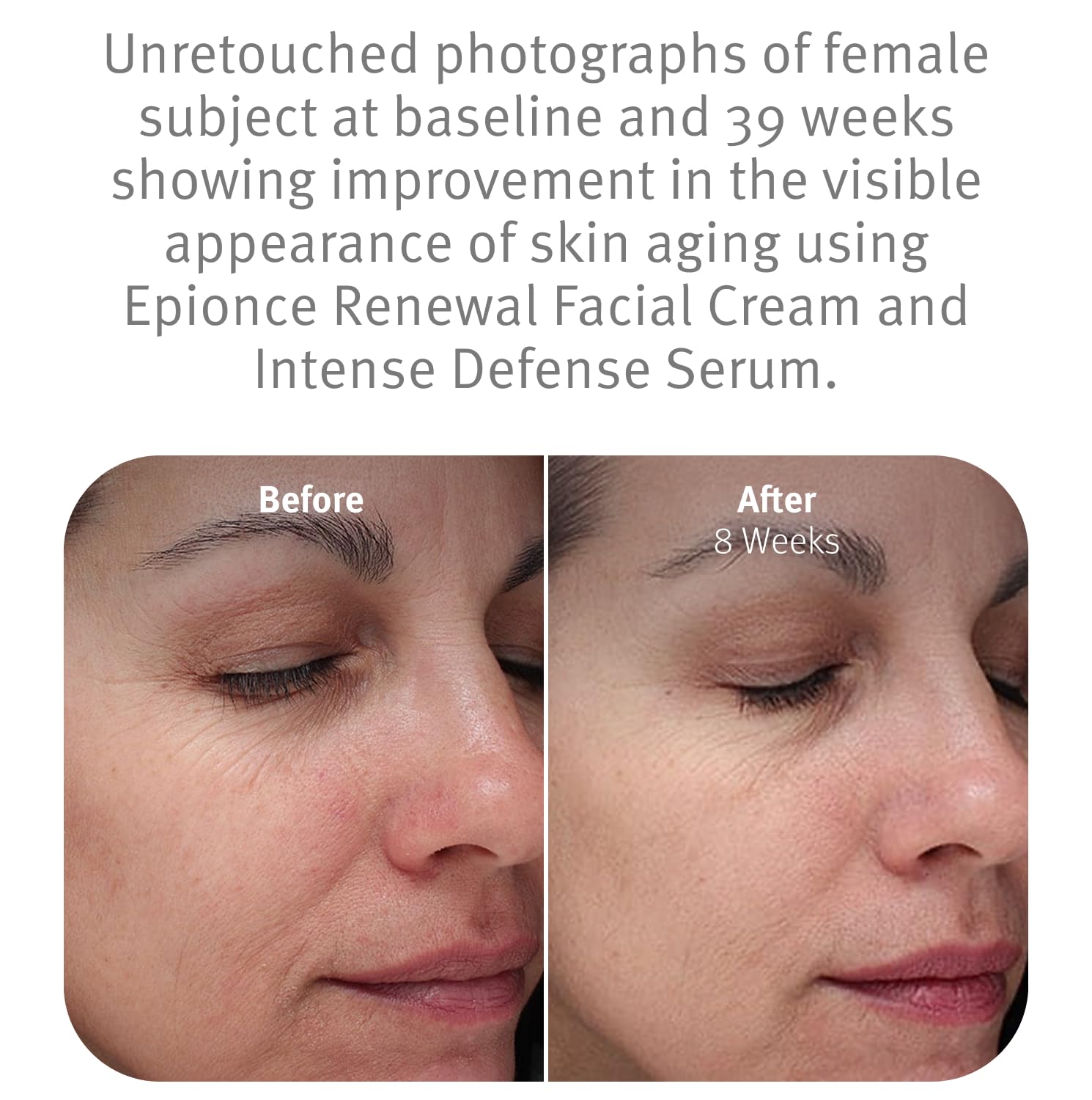 Epionce Renewal Facial Cream, an anti-aging skin moisturizer with barrier benefits, displayed in a jar with a smooth cream texture.