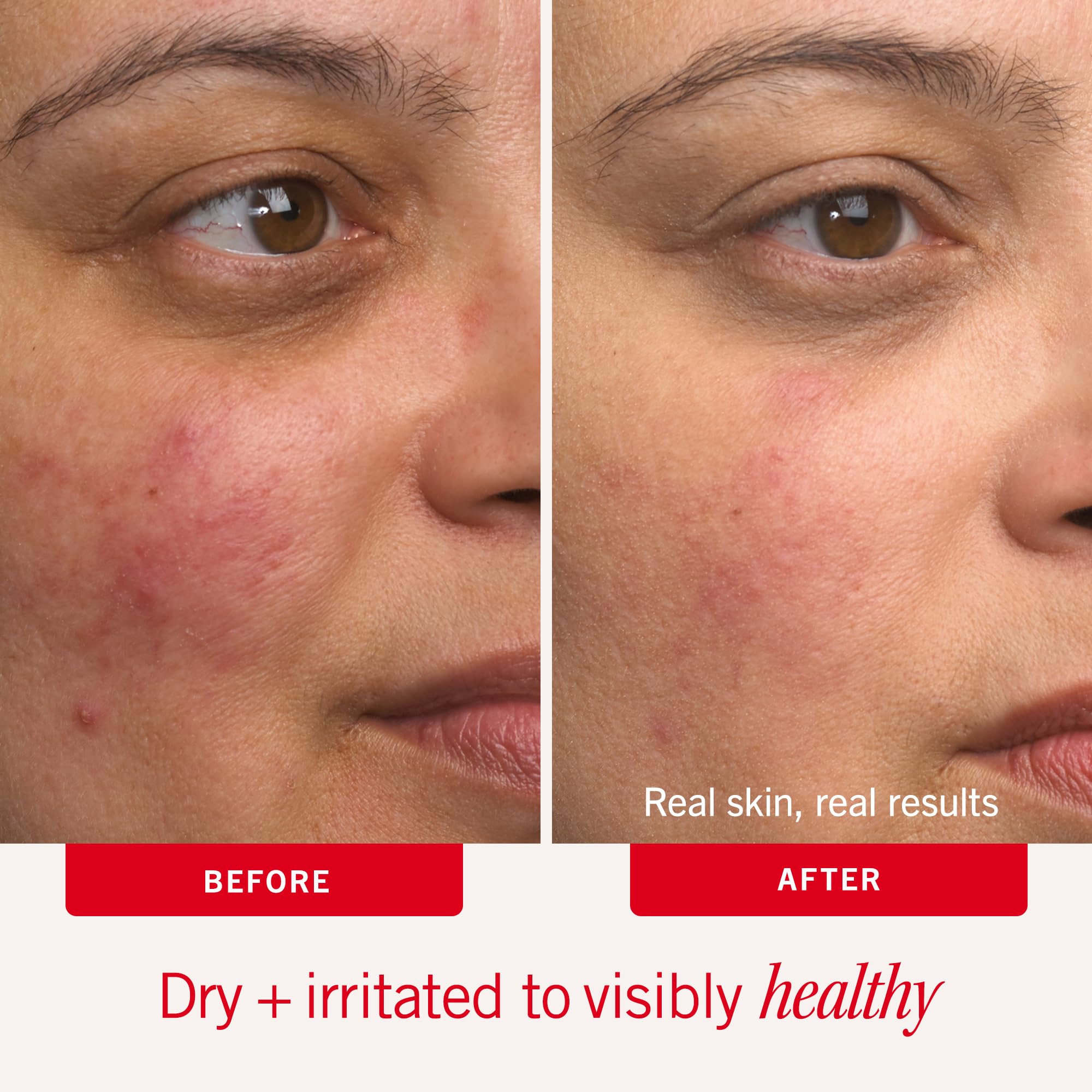 First Aid Beauty Ultra Repair Cream 7oz fragrance-free skin moisturizer jar with smooth, creamy texture and labeled lid.