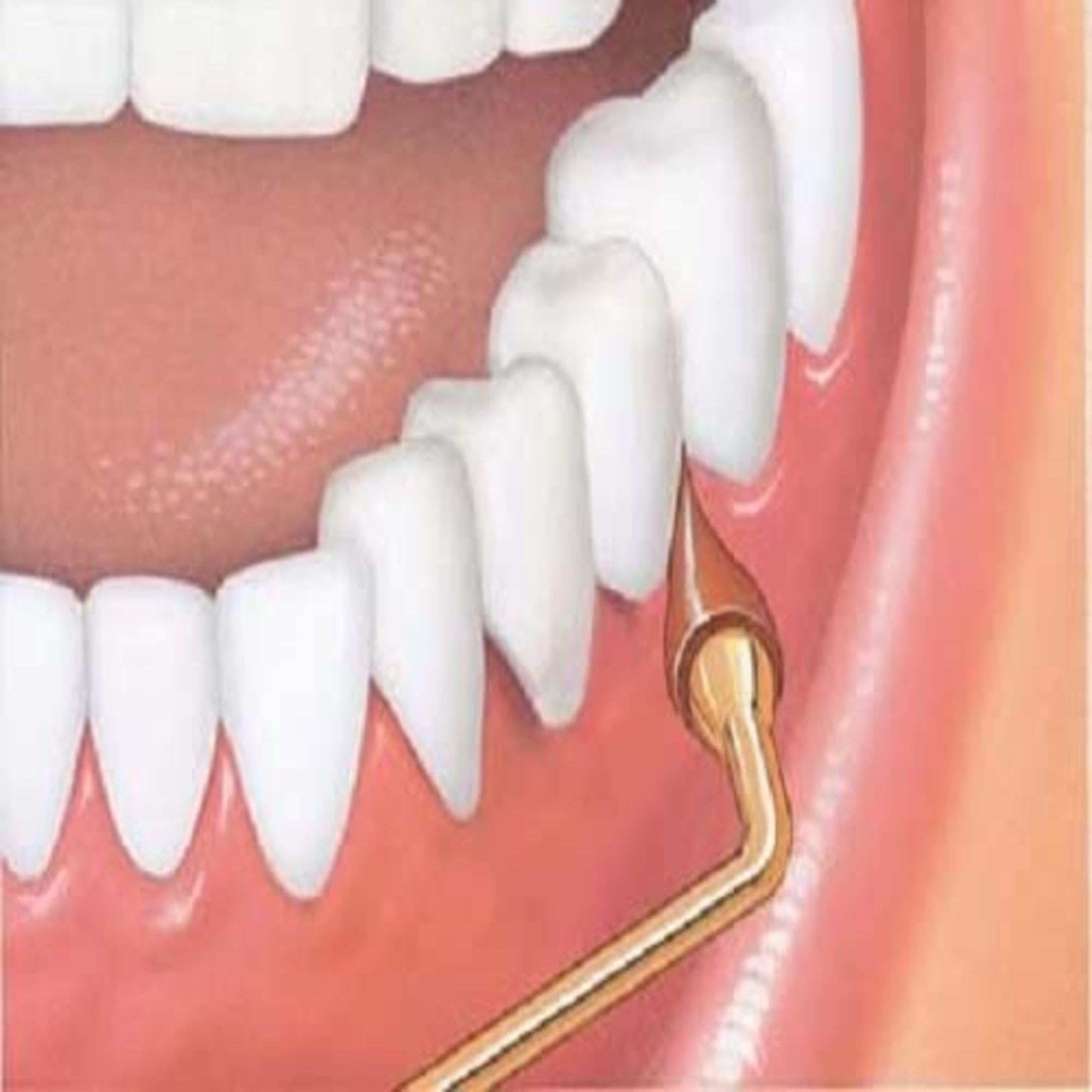 GUM Rubber Tip Stimulator and Gum Massager for professional healthcare, designed to remove plaque and promote gum health.