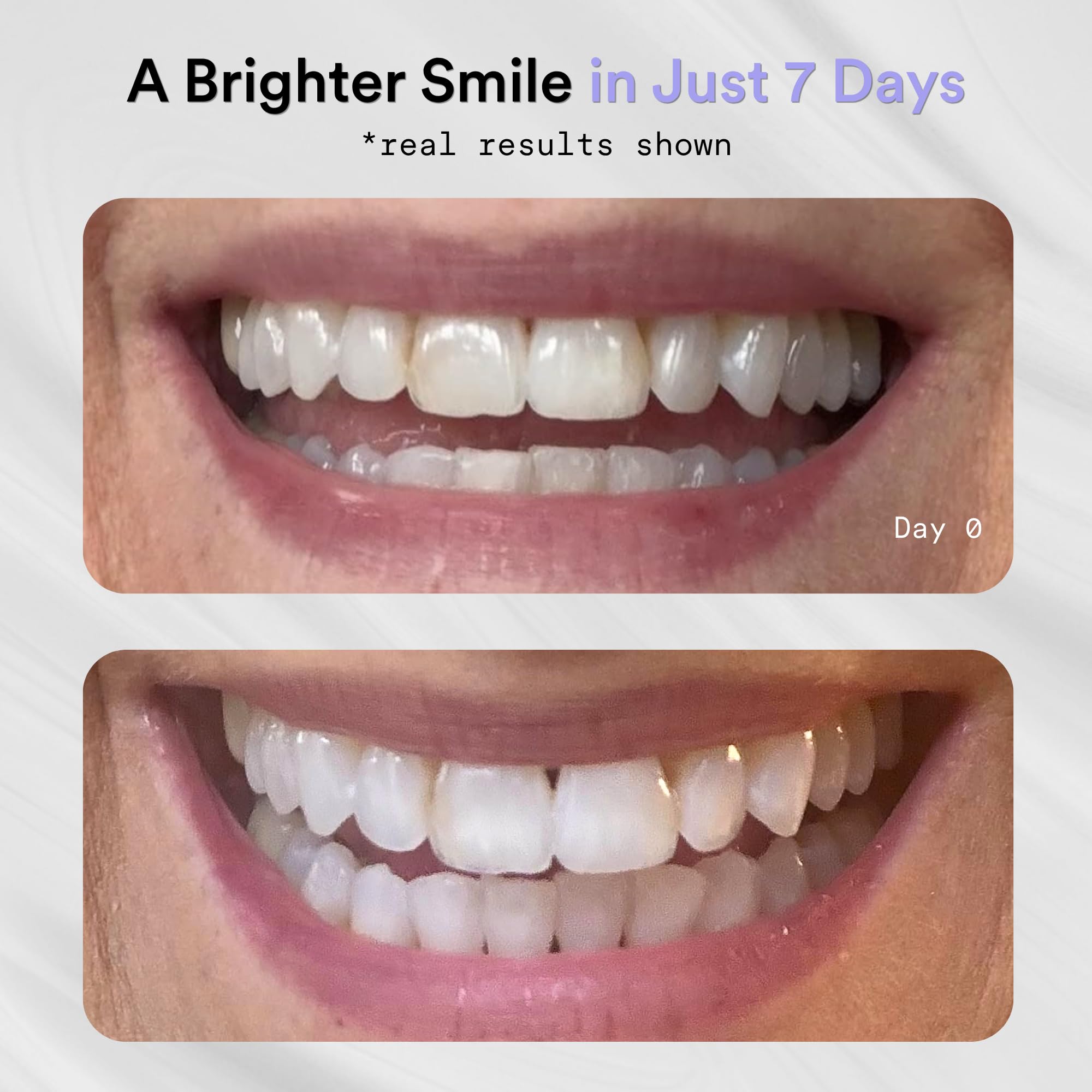 La Bouche Natural whitening strips for teeth, peroxide-free, 14 count; showing the strips laid out for whitening treatment.