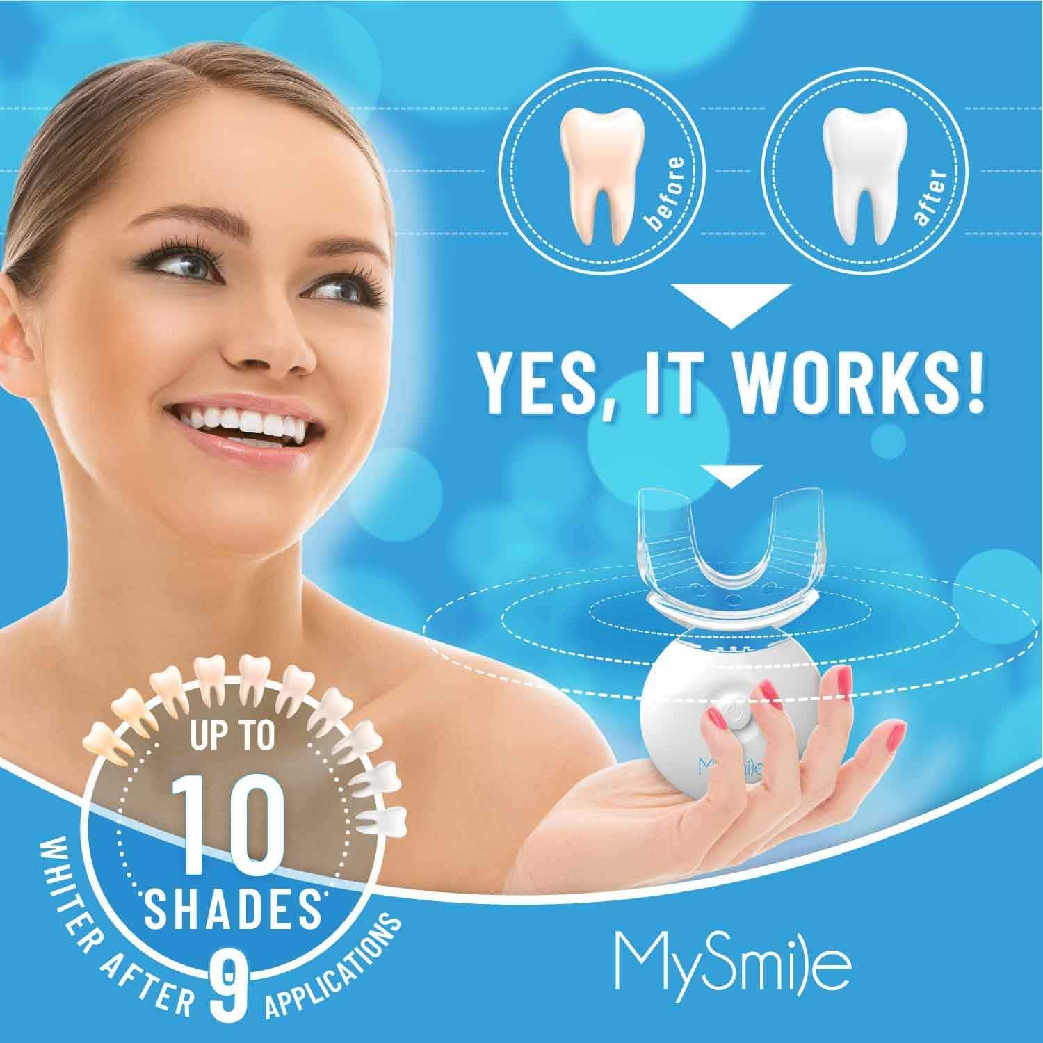 MySmile Teeth Whitening Kit with LED light and gel, showing the whitening trays and gel applicator for brightening teeth.