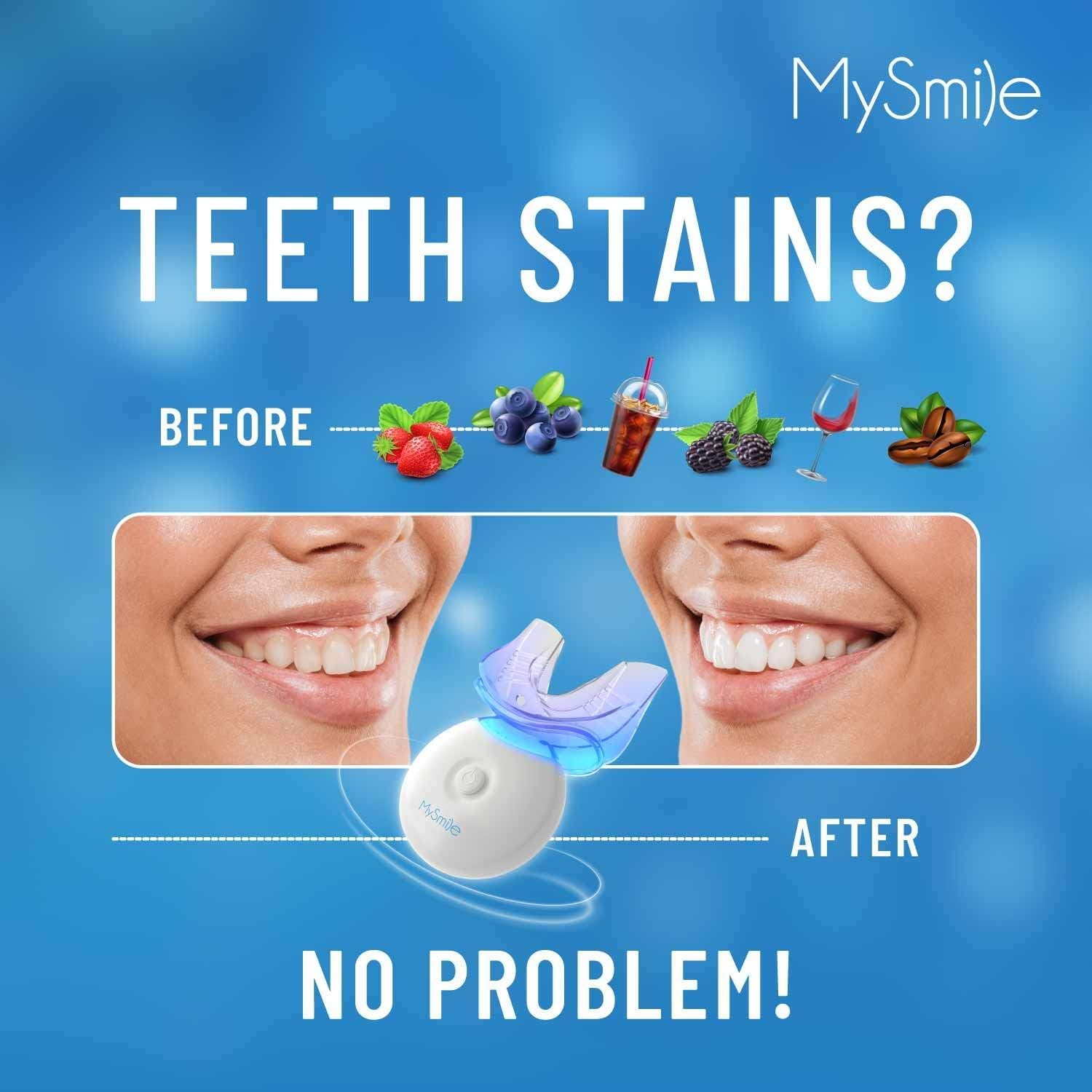 MySmile Teeth Whitening Kit with LED light and gel for at-home teeth whitening, featuring whitening trays and light device.