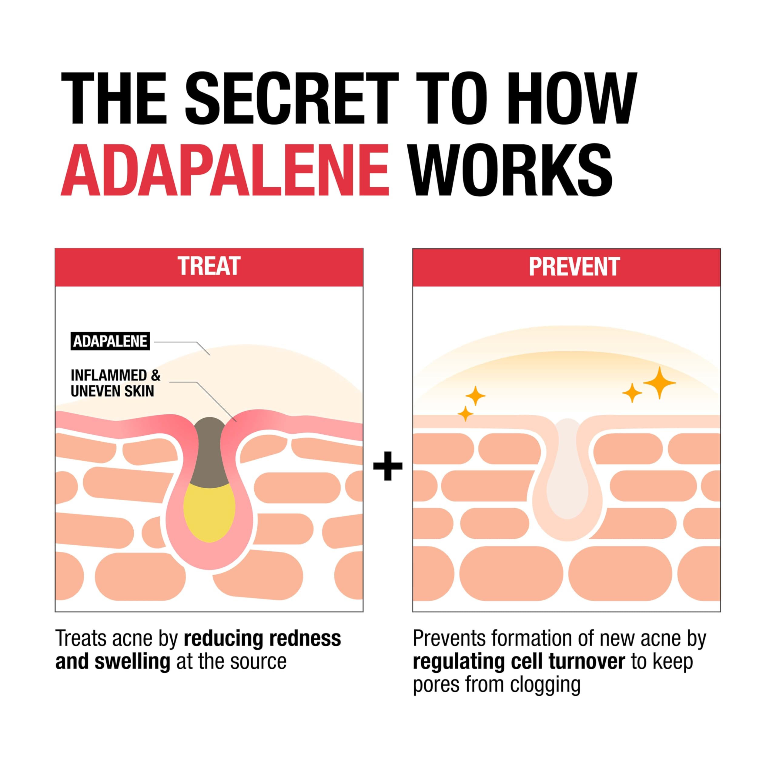 Neutrogena 0.1% Adapalene Gel acne treatment in a 1.6 oz tube, clear medication for acne-prone skin.