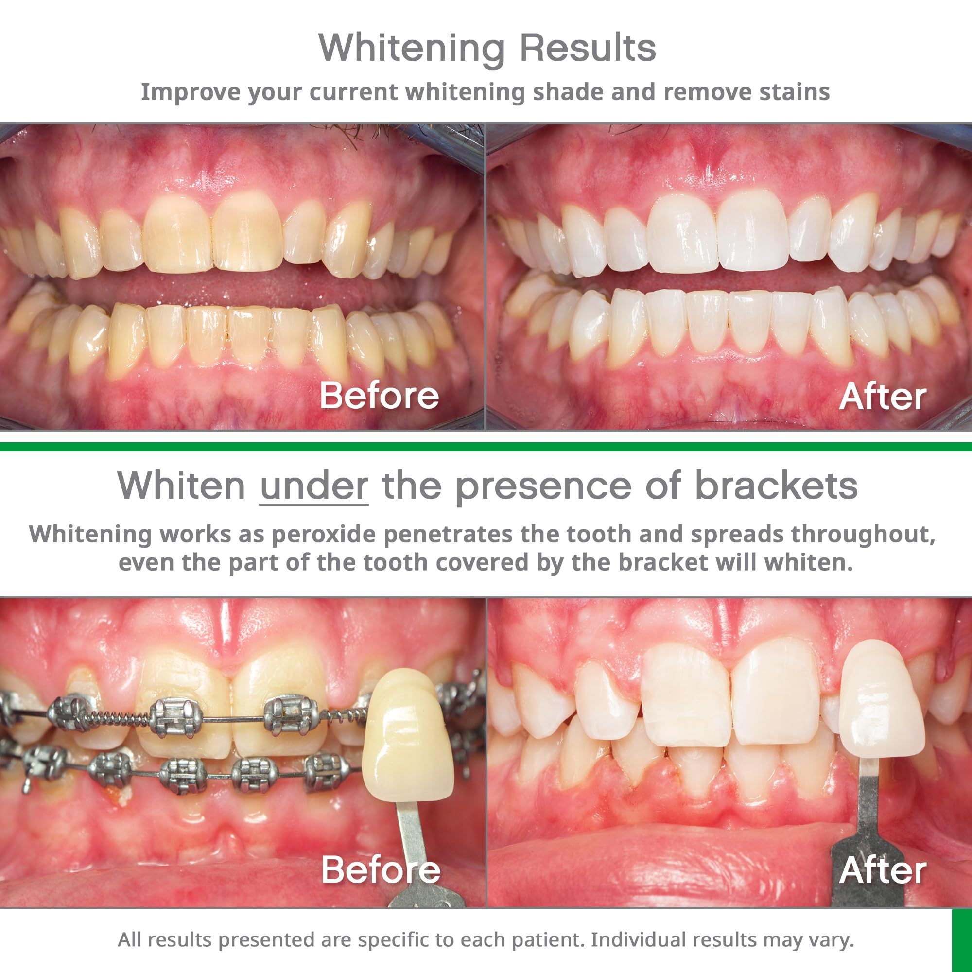 Opalescence Go 10% prefilled teeth whitening trays, 10-pack, showing the clear, custom-fit tray for at-home teeth whitening.