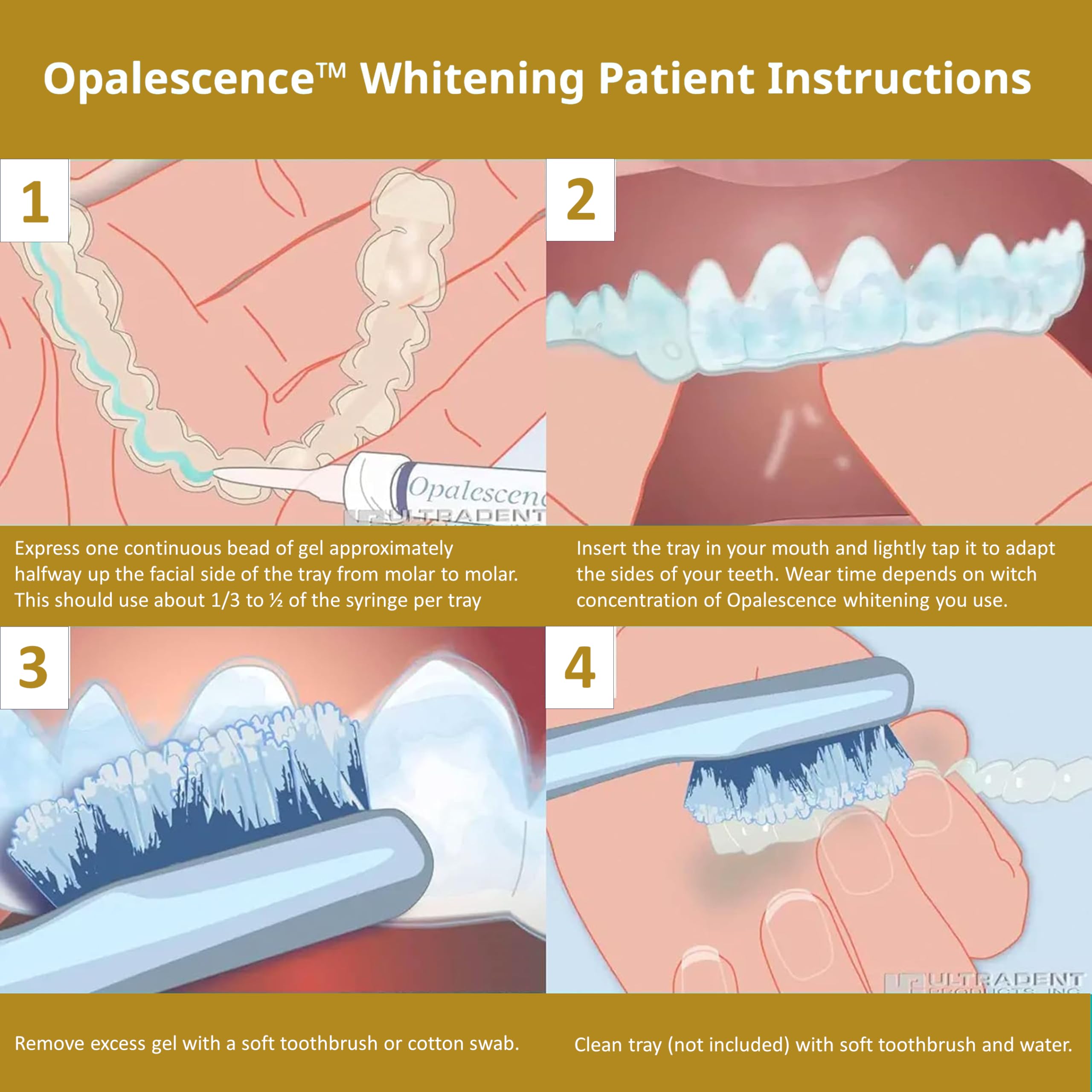 Opalescence 45% teeth whitening gel in four syringes, dental whitening product for professional use.