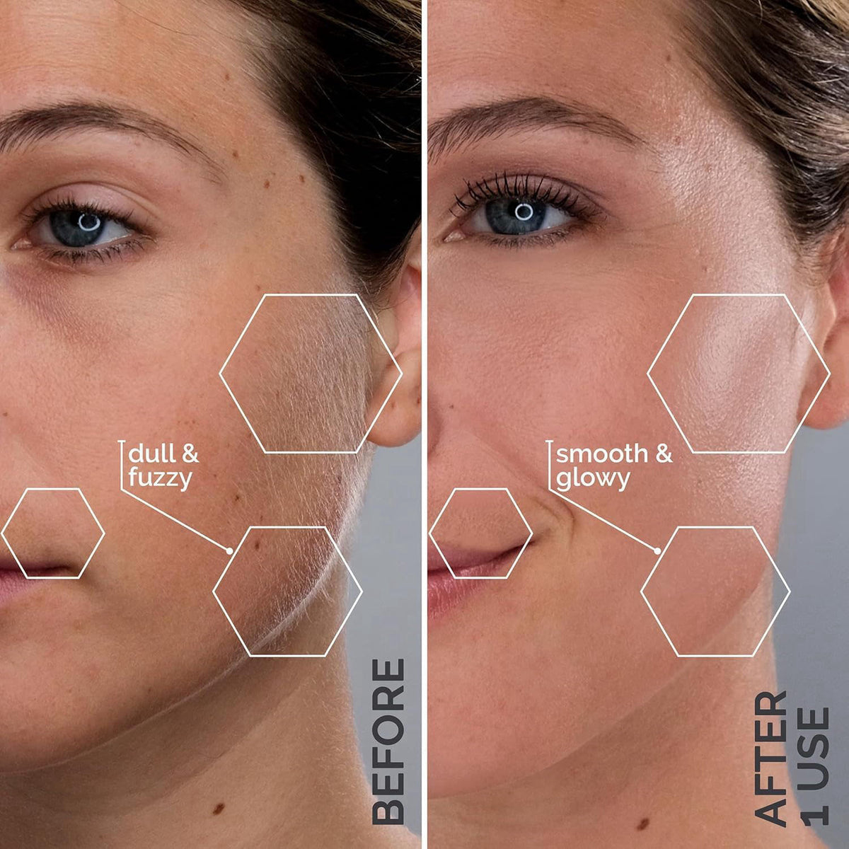 SPA SCIENCES - SIMA Patented Sonic Dermaplane Razor for Women Face – full view