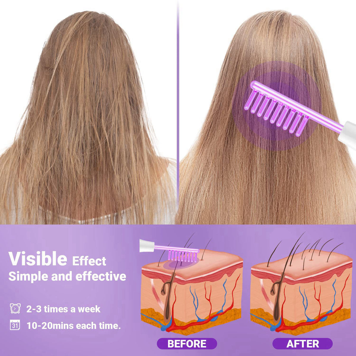 High Frequency Facial Wand-UUPAS Portable Handheld High Frequency – alternate angle
