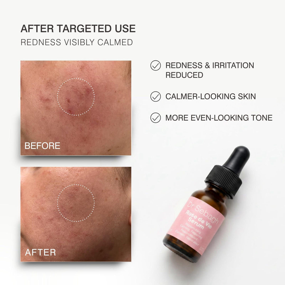 Dr Sebagh Rose de Vie Serum - Soothing & Anti-Aging Serum with Organic Oils & Antioxidants to Hydrate, Calm, and Protect