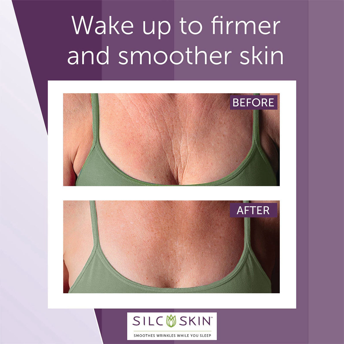 Silc Skin Decollette Pad for Chest Wrinkles, 30 Day Supply – packaging and label