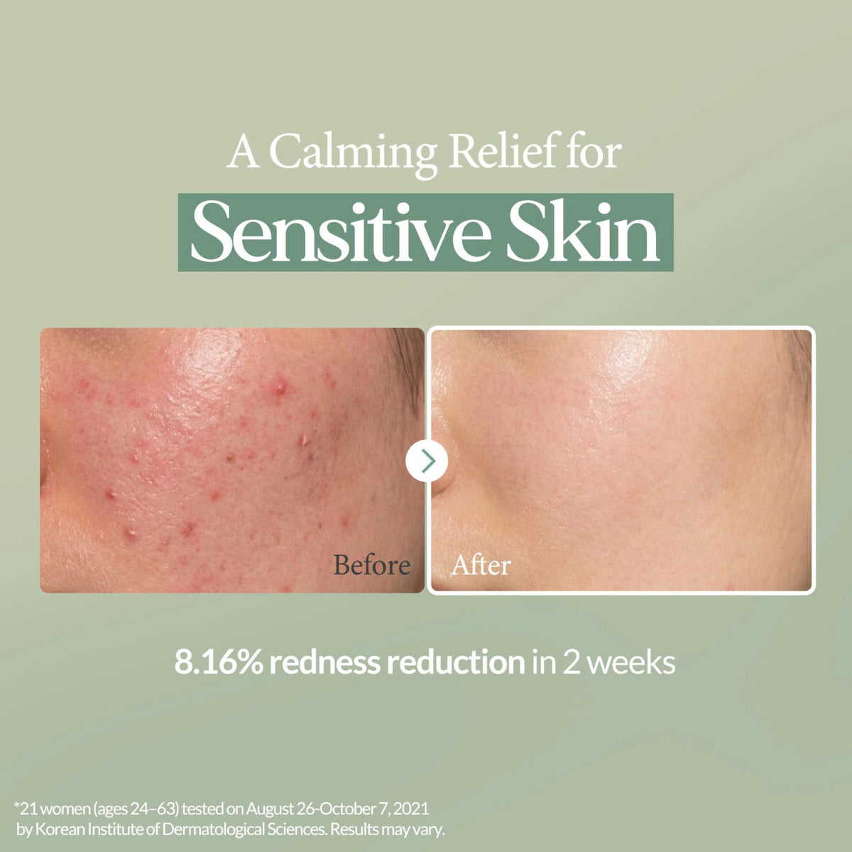 LU'PIUM Calming Repair Serum with Cica and Madecassoside (1.69 fl. oz.) – packaging and label