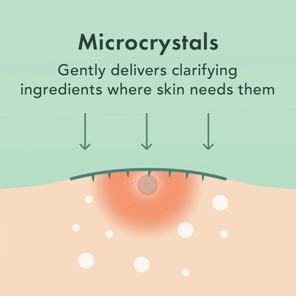 Rael Miracle Microcrystal Spot Cover Hydrocolloid Pimple Patches (36 Ct) – full view