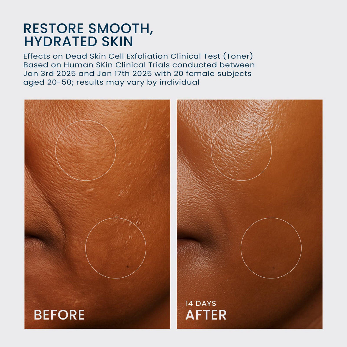mimmua! NIACINDY Glow Reset Toner + Volume UP Serum Set for Daily Skincare – close-up detail