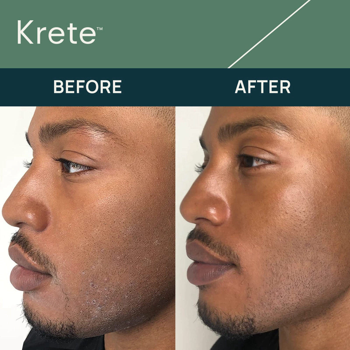 KRETE 30-Seconds Hydrating Facial Serum for Men - Helps with the Appearance of Aging, Wrinkles, Eye Bags, & Redness - Mo
