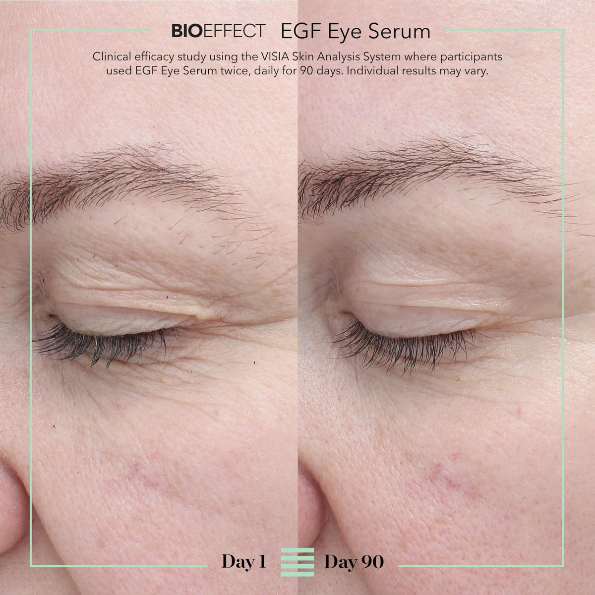 BIOEFFECT EGF Eye Serum, Age-Defying for Wrinkles & Crow's Feet 0.20 oz – packaging and label