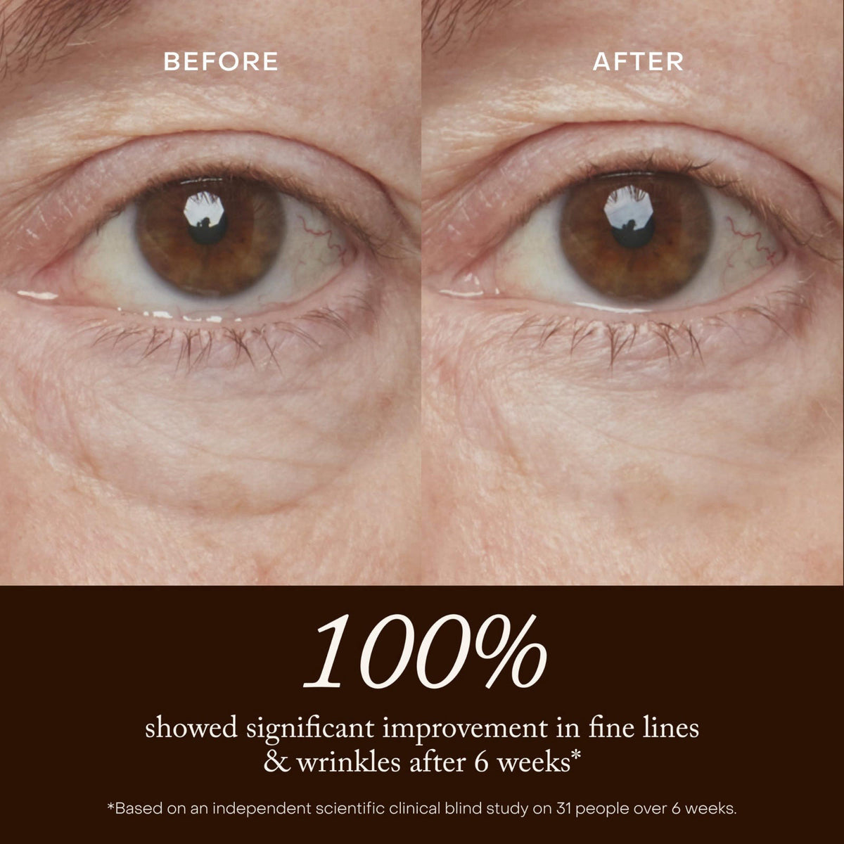 True Botanicals Resurrection Radiance Eye Cream for Dark Circles, 0.5 oz – full view