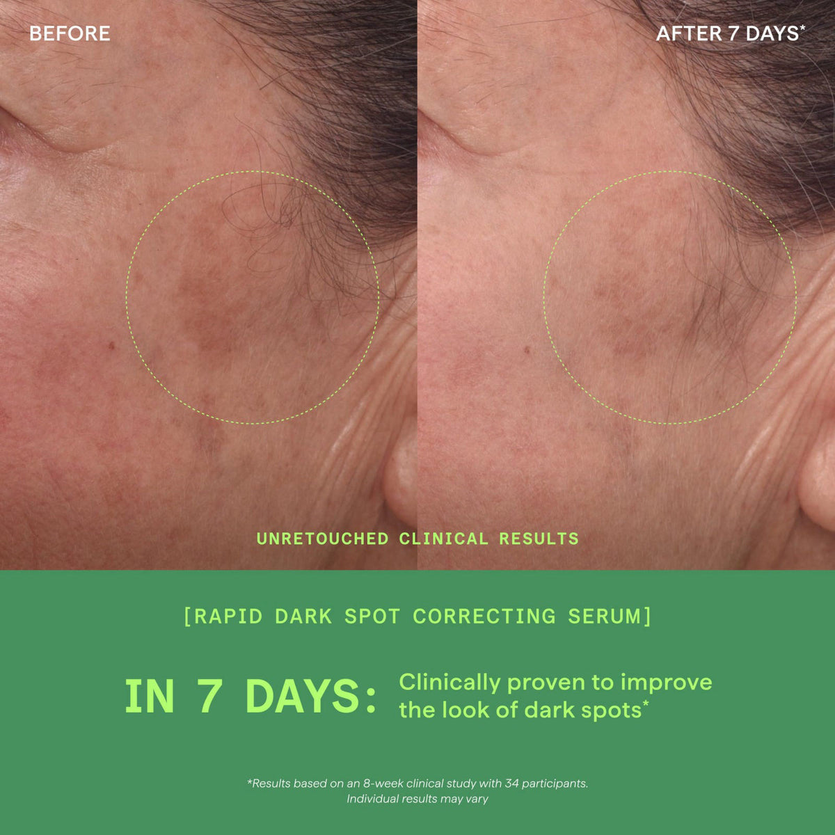 Murad Rapid Dark Spot Correcting Serum - Glycolic Acid - 1 Fl Oz – full view