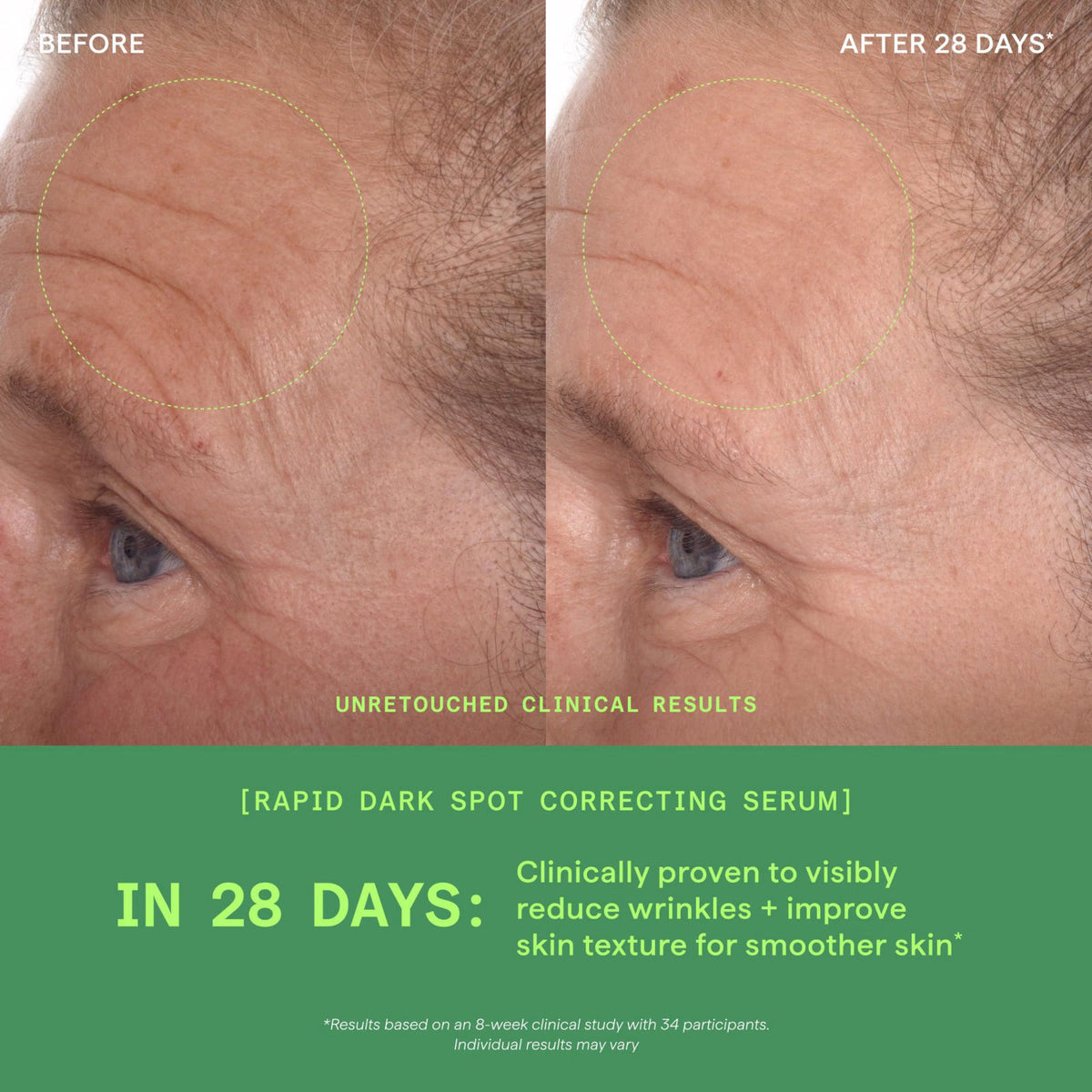 Murad Rapid Dark Spot Correcting Serum - Glycolic Acid - 1 Fl Oz – back view and specifications