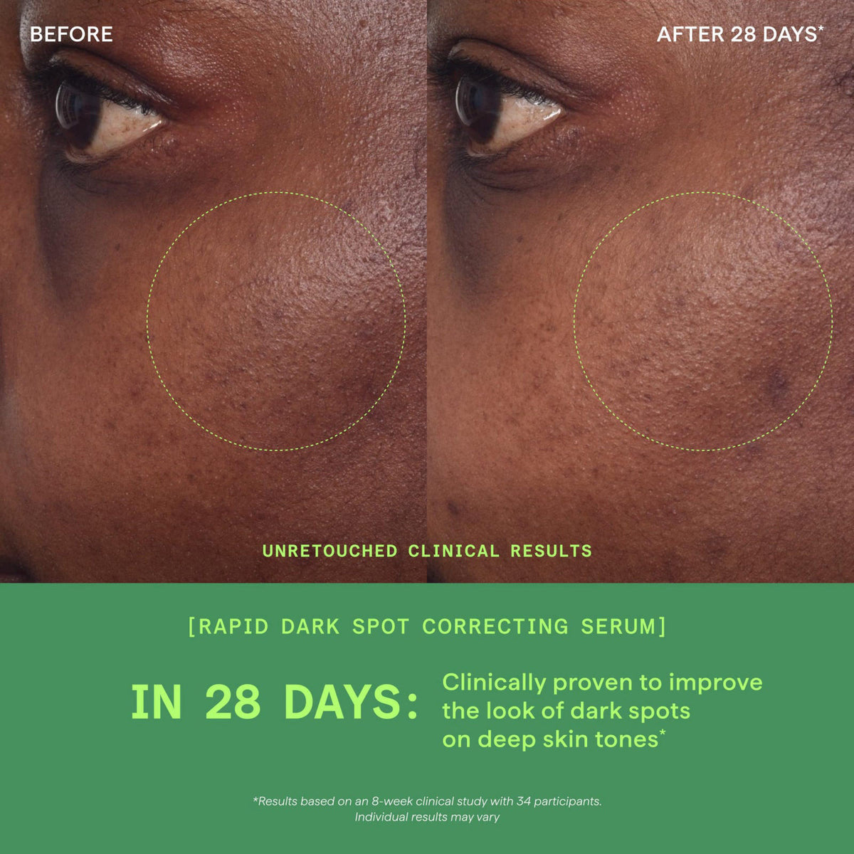 Murad Rapid Dark Spot Correcting Serum - Glycolic Acid - 1 Fl Oz – alternate angle