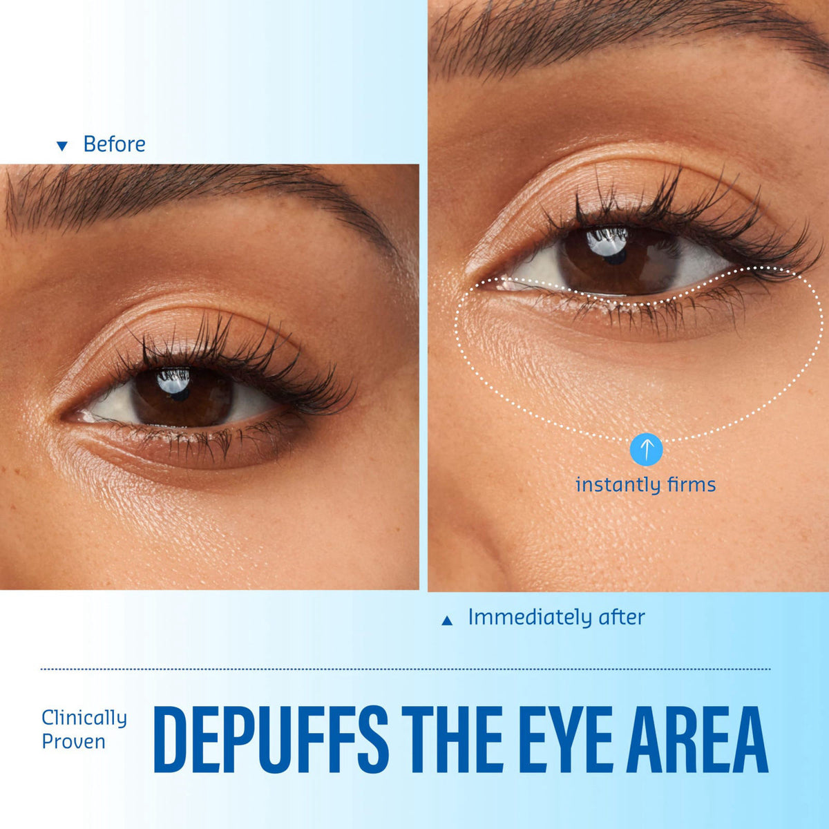 belif Aqua Bomb Cooling Eye Gel with Ceramic Tip for Depuffing, 0.5 fl oz – full view, size 0.5 Fl Oz (Pack of 1)