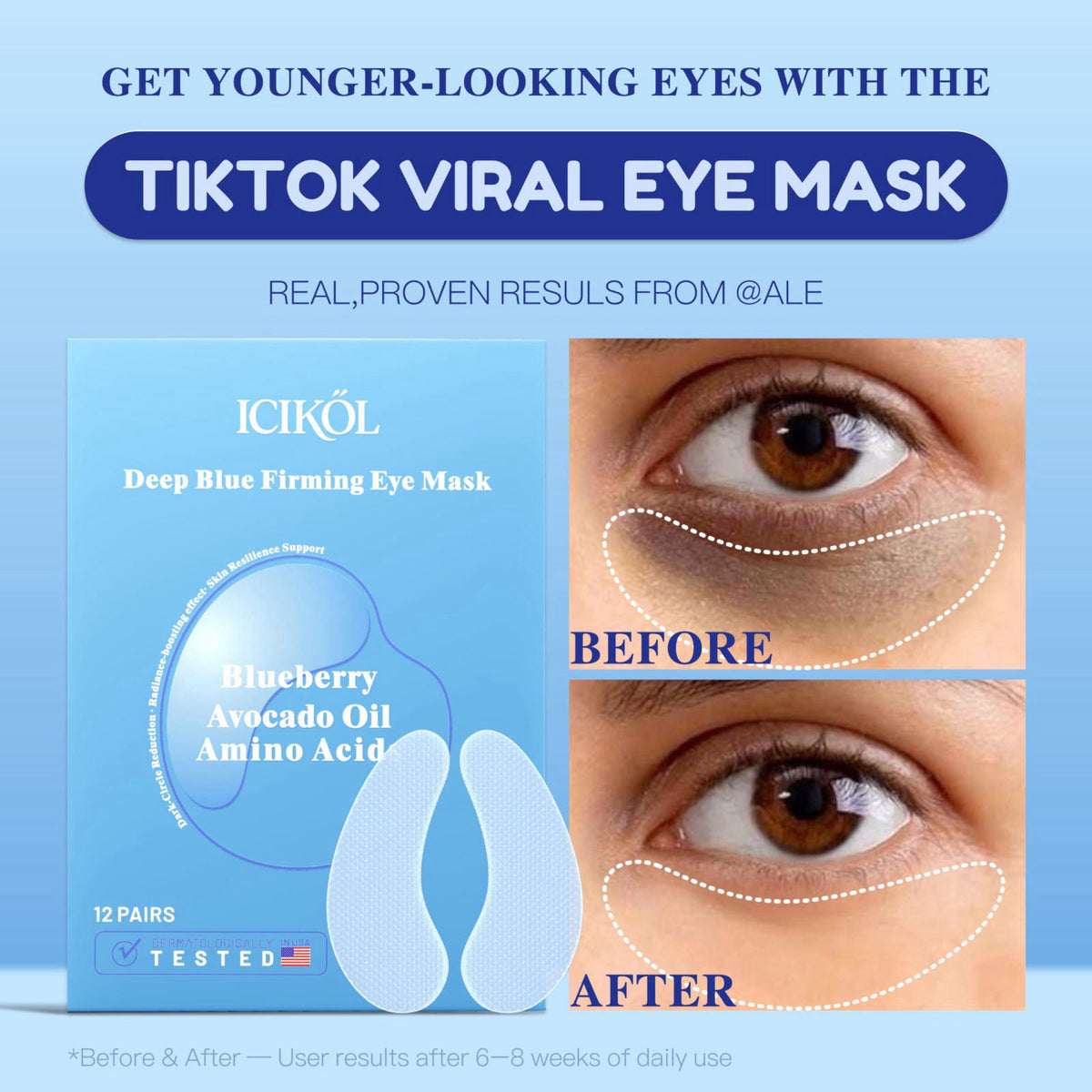 ICIKOL Blueberry Collagen Under Eye Patches, Eye Mask for Puffy Eyes and Dark Circles, Deep Hydrating Under Eye Mask Pat