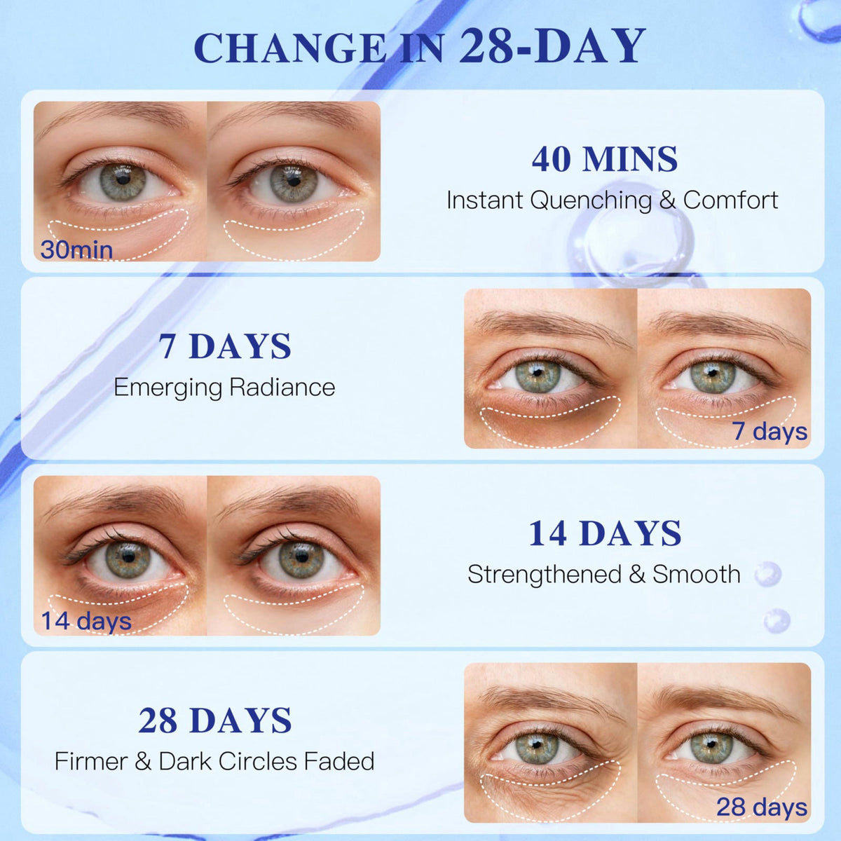 ICIKOL Blueberry Collagen Under Eye Patches, Eye Mask for Puffy Eyes and Dark Circles, Deep Hydrating Under Eye Mask Pat