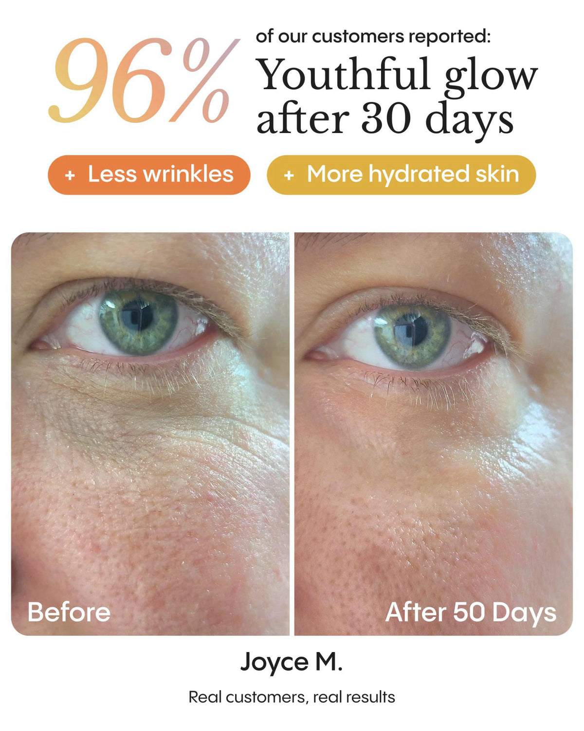 FR&Oslash;YA Organics Hyper Potent Dark Circles & Bag Eye Balm (0.5 oz) – back view and specifications
