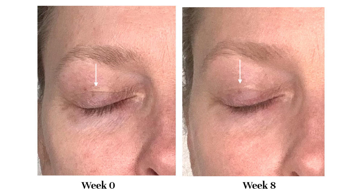 City Beauty Lid Lifting Treatment - Eyelid Firming Eye Cream, 0.33oz – alternate angle