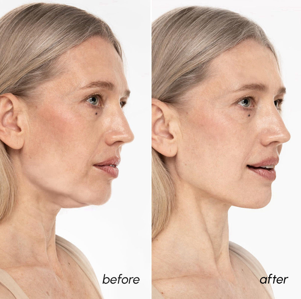 MAREE V Line Lifting Mask - Gold Face Lift Tape & Double Chin Lifting Mask – back view and specifications