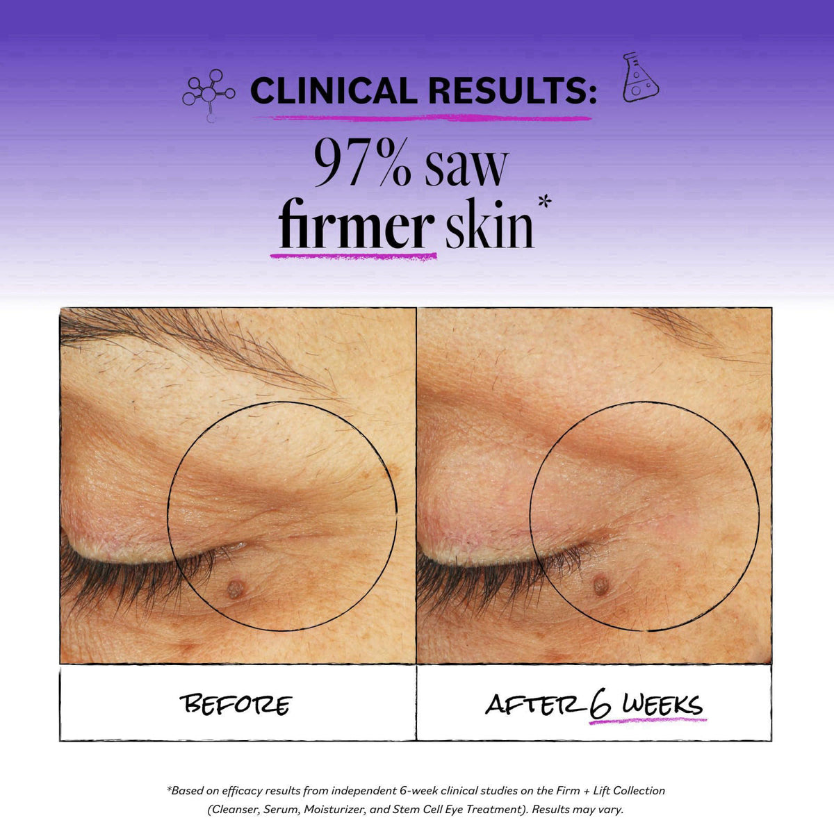 DERMA E Stem Cell Lifting Eye Cream, Firming & Tightening, 0.5 oz – packaging and label