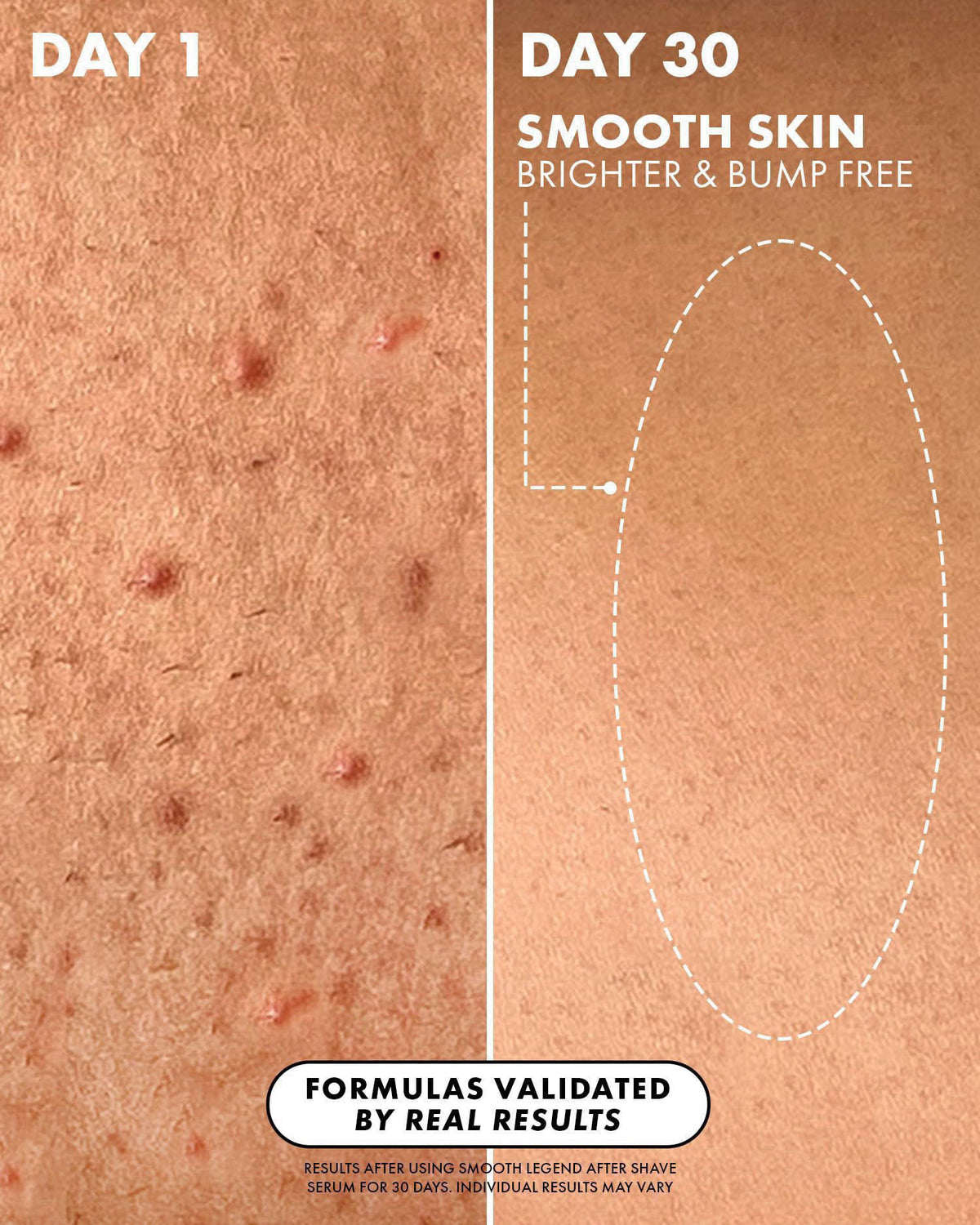 Truly Beauty Luxury After Shave Serum | Soothing & Hydrating Post Shave Treatment to Prevent Ingrown Hair For Smooth, Ir