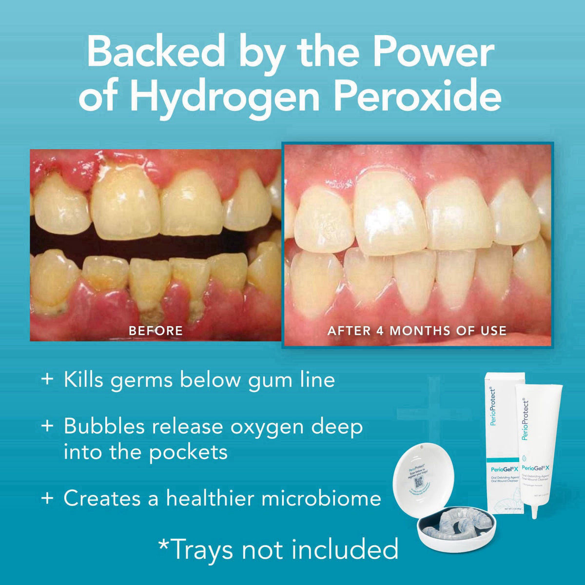 Perio Protect – Gels on display
