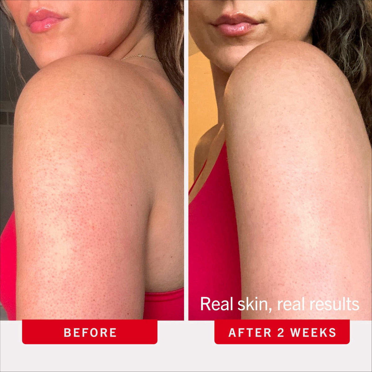 First Aid Beauty KP Bump Eraser Body Scrub, 10% AHA Body Exfoliator – back view and specifications
