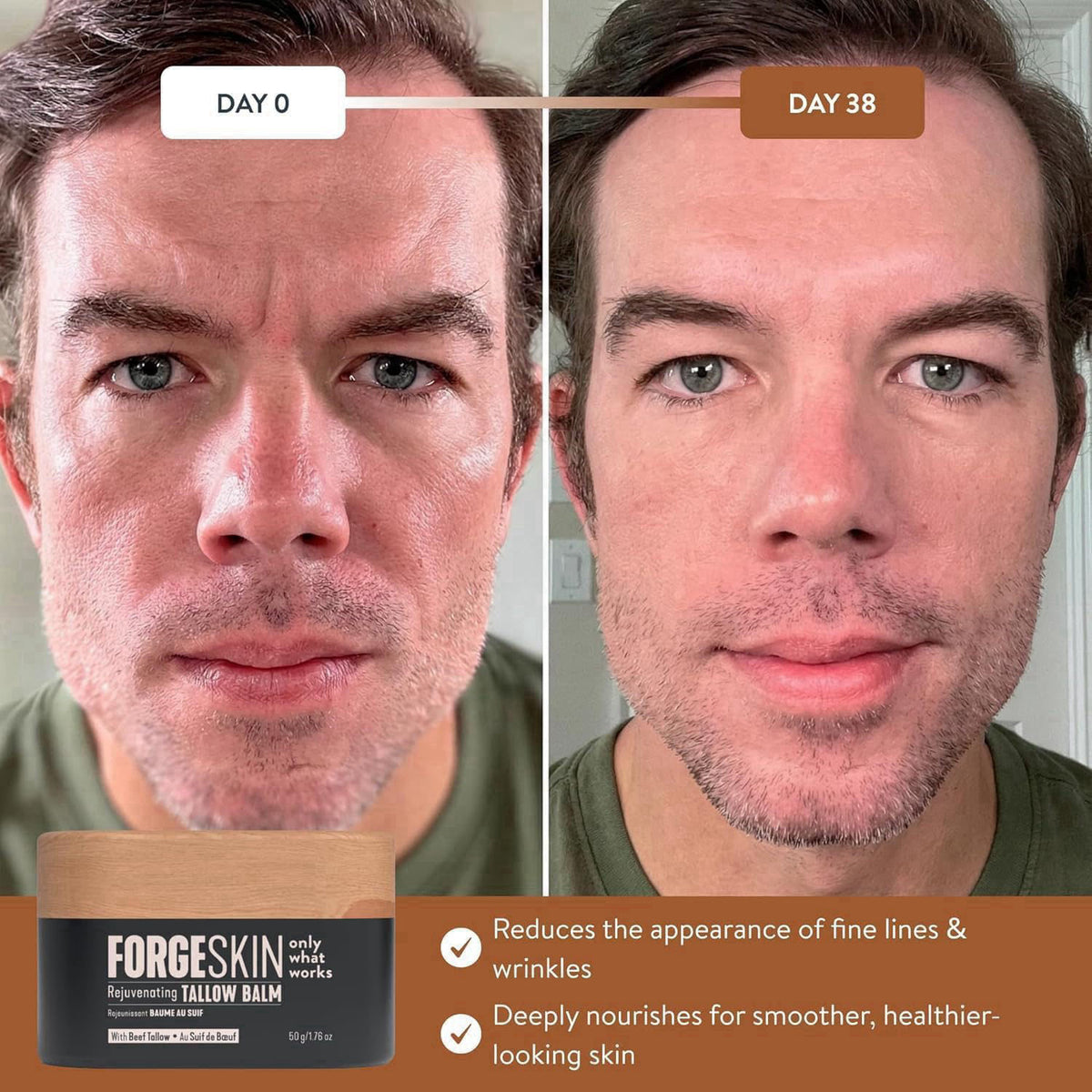 Forge Skin Beef Tallow Balm Skin Moisturizer for Men, Anti Aging Wrinkle Defense - Face & Body Skincare Hydration Cream,