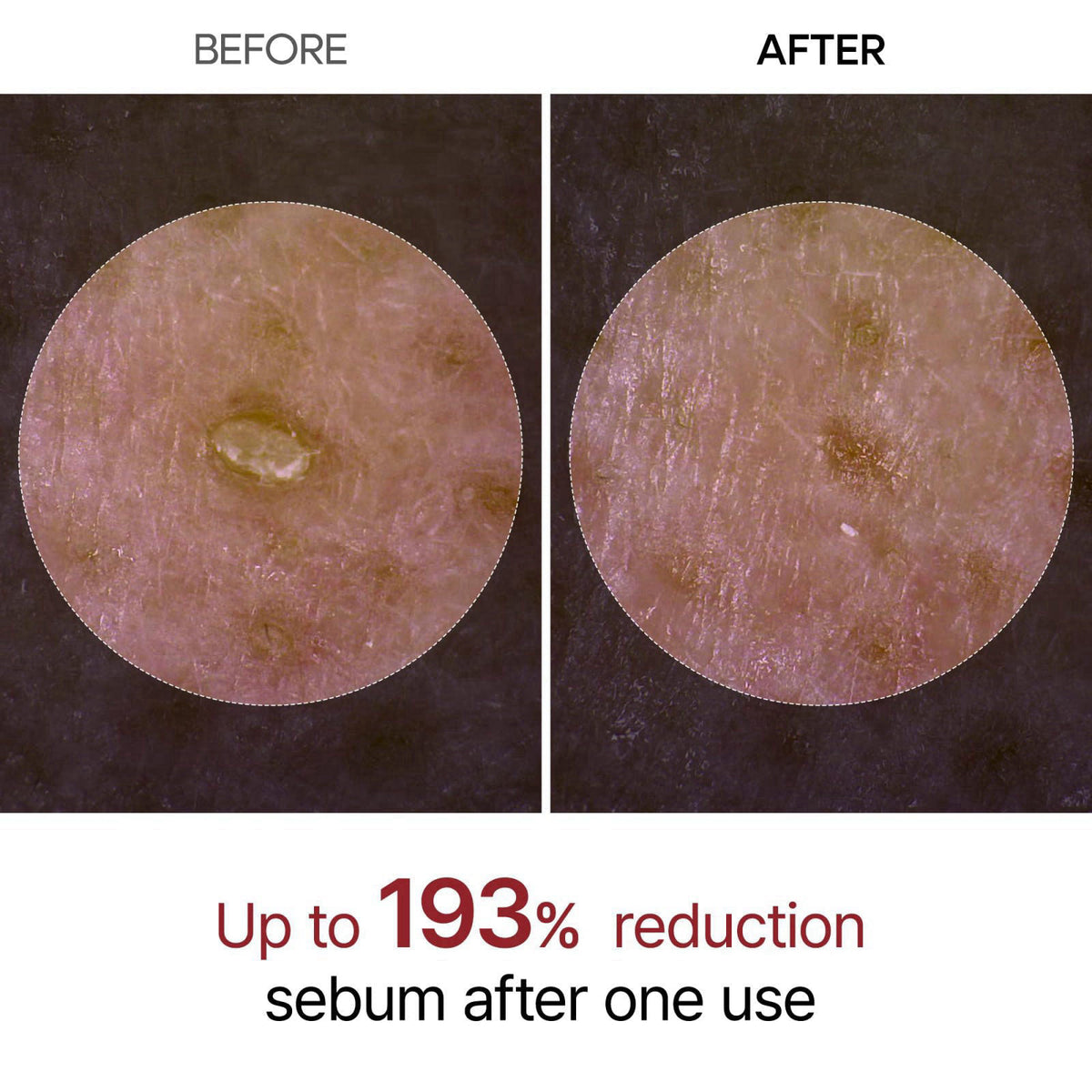 Dr.Melaxin Peel Shot Glow White Rice Peeling Ampoule with Rice Extract & AHA BHA, Gentle Exfoliating Serum for Sebum Con