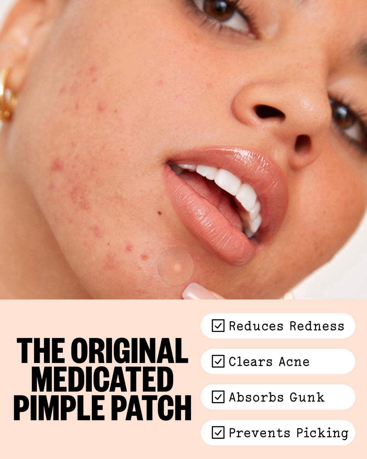 PEACE OUT Acne Healing Dots Medicated Hydrocolloid Pimple Patches (40 ct) – packaging and label