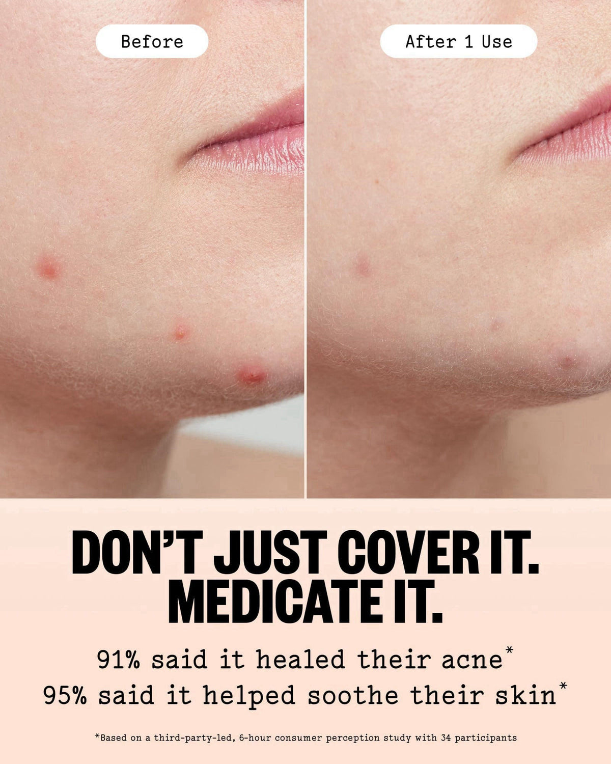 PEACE OUT – Pore Cleansing Strips on display